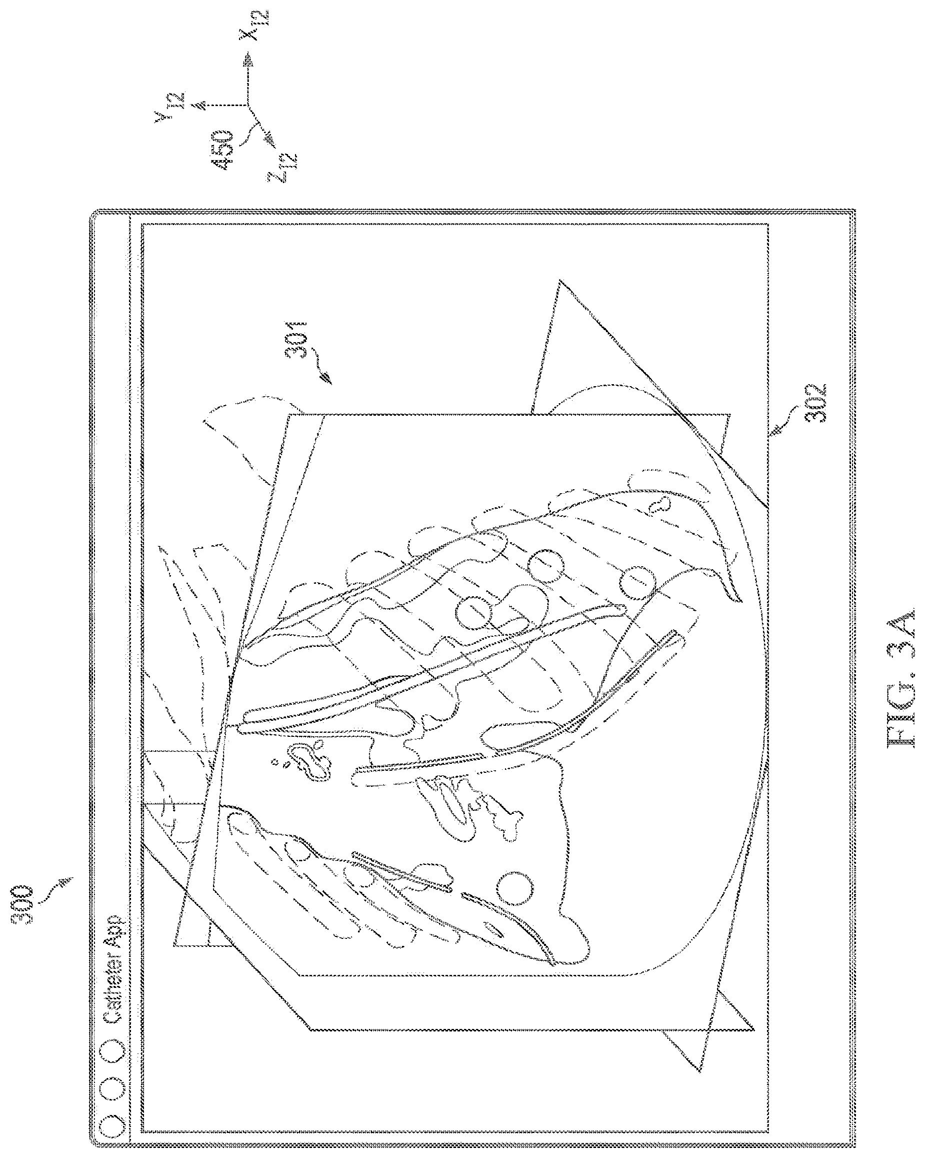 Patent US12597135 Figure 3 – Systems and methods for updating a graphical user interface based upon intraoperative imaging
