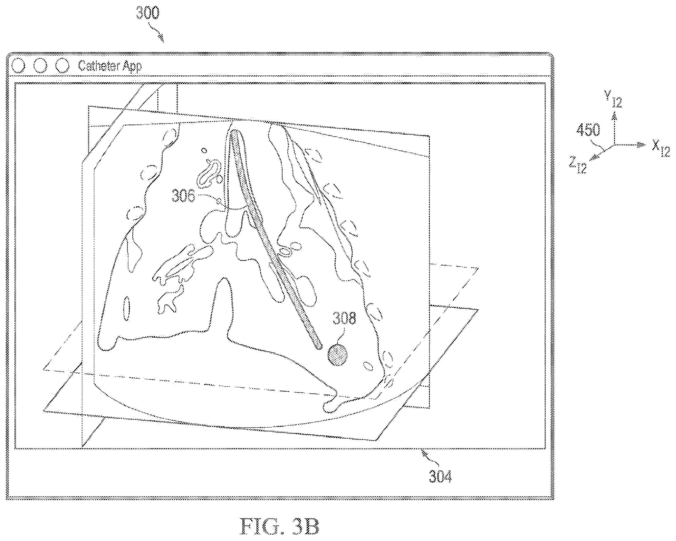 Patent US12597135 Figure 4 – Systems and methods for updating a graphical user interface based upon intraoperative imaging