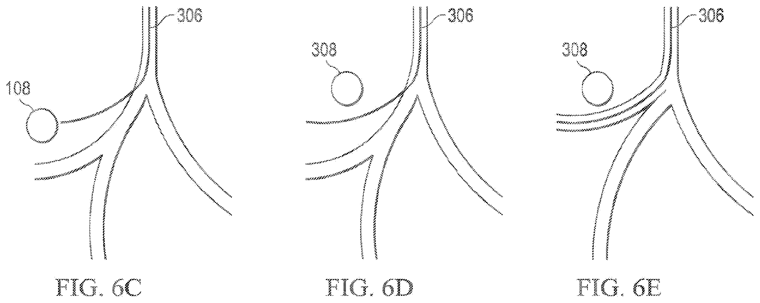 Patent US12597135 Figure 7 – Systems and methods for updating a graphical user interface based upon intraoperative imaging