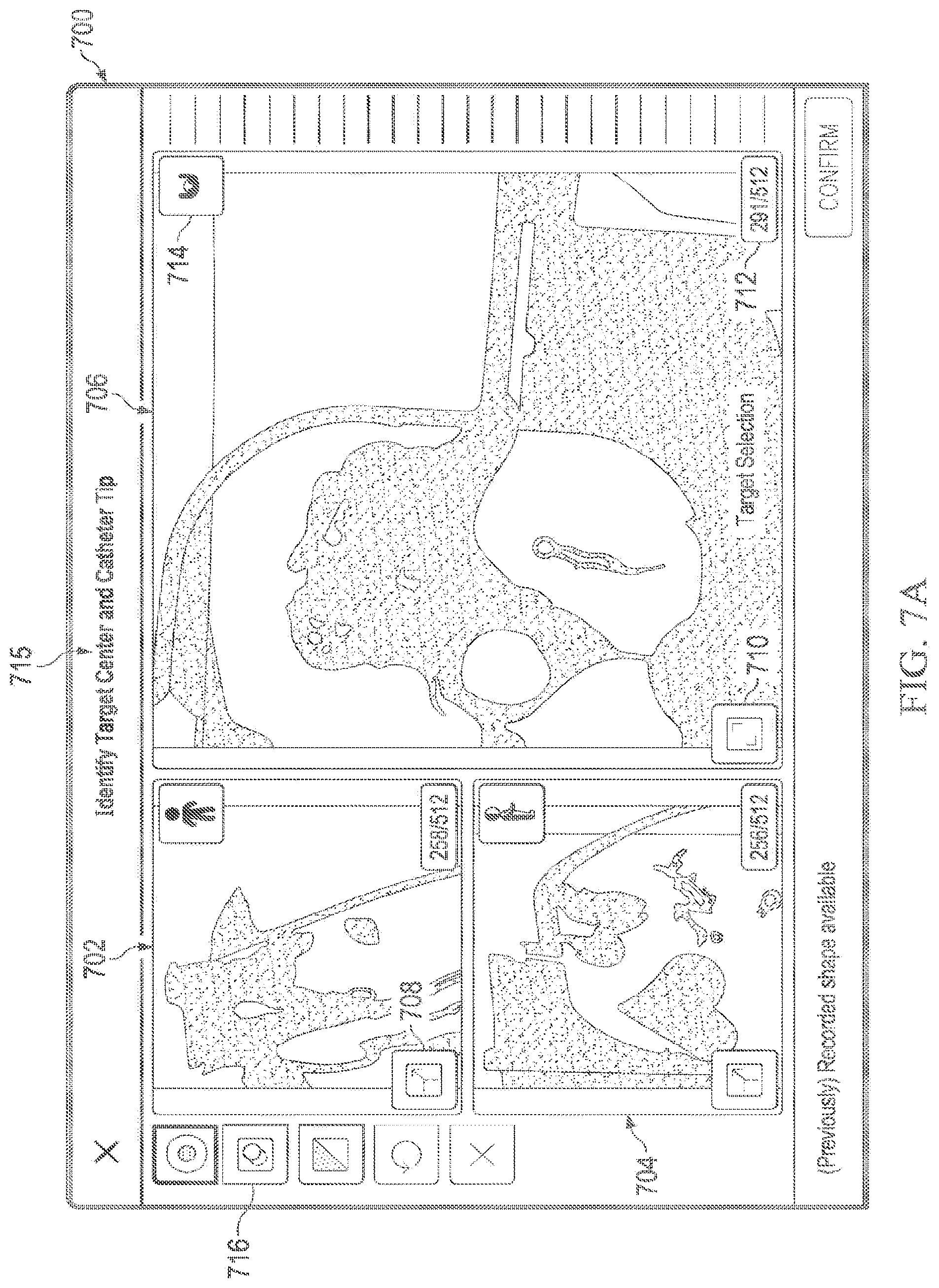 Patent US12597135 Figure 8 – Systems and methods for updating a graphical user interface based upon intraoperative imaging
