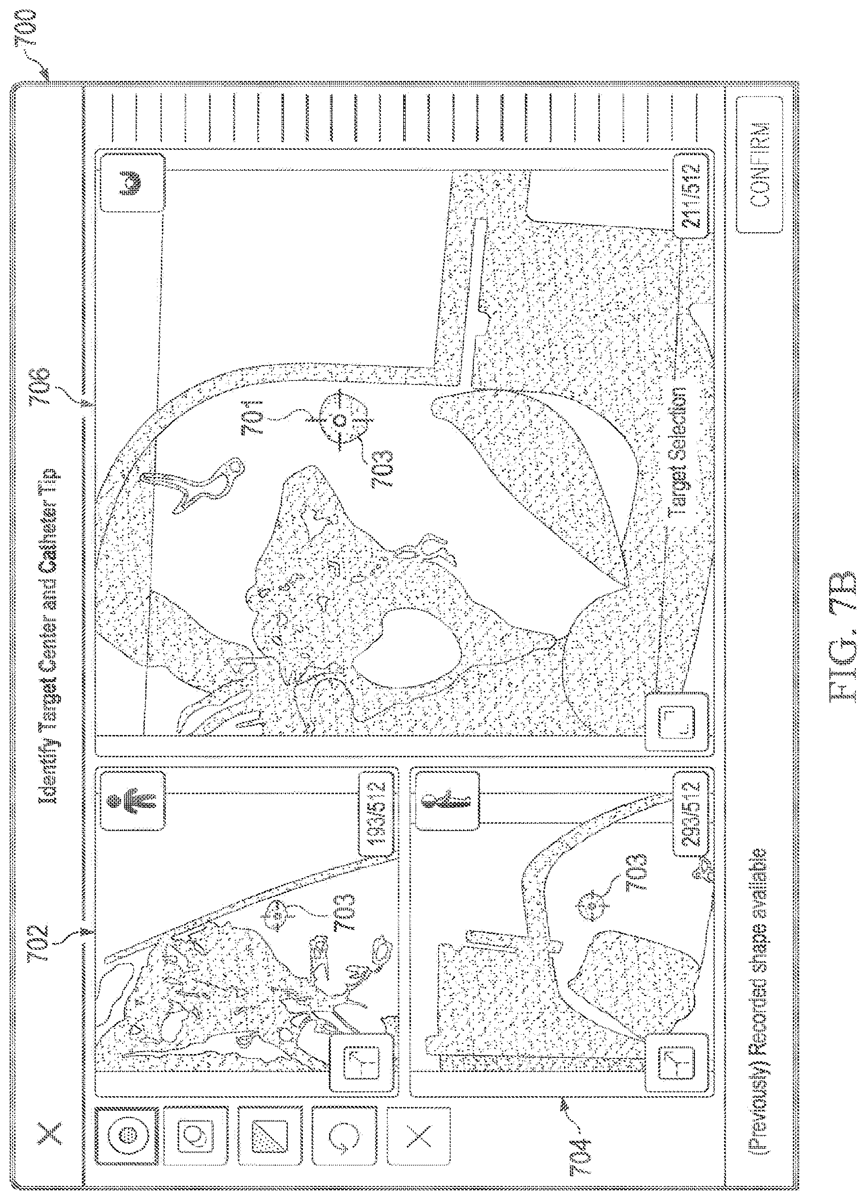 Patent US12597135 Figure 9 – Systems and methods for updating a graphical user interface based upon intraoperative imaging
