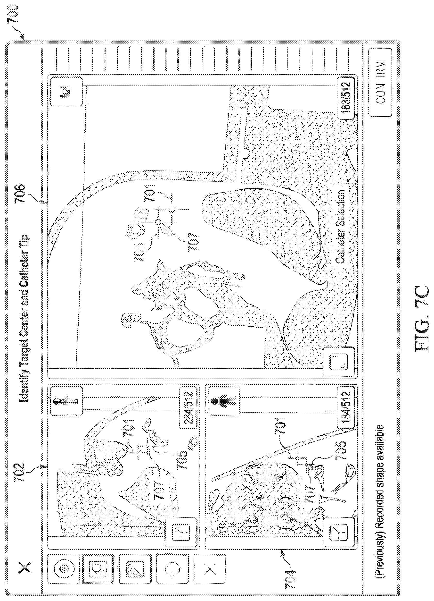 Patent US12597135 Figure 10 – Systems and methods for updating a graphical user interface based upon intraoperative imaging