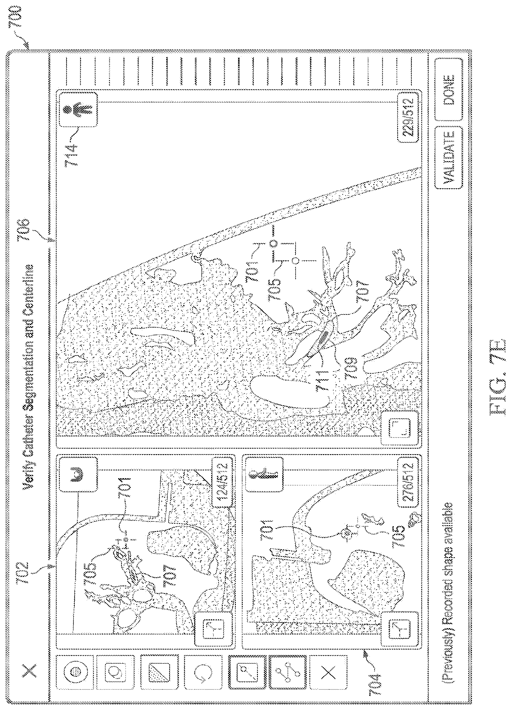 Patent US12597135 Figure 12 – Systems and methods for updating a graphical user interface based upon intraoperative imaging