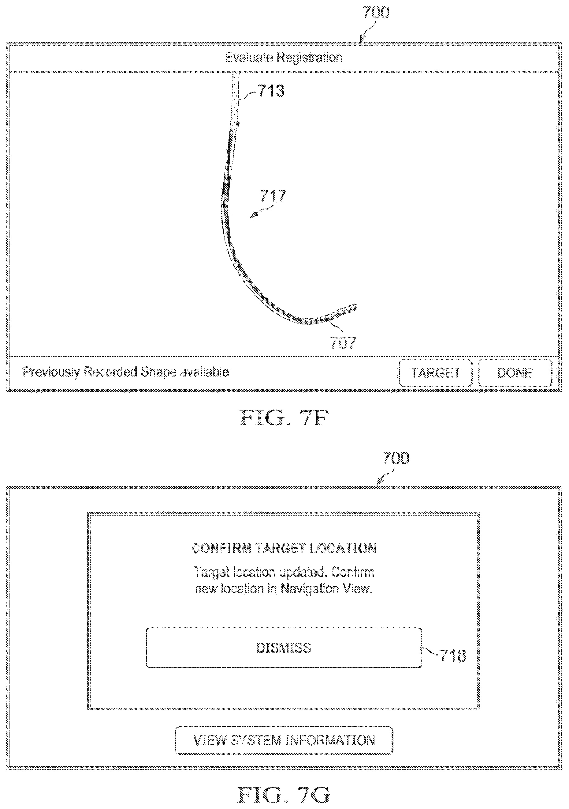 Patent US12597135 Figure 13 – Systems and methods for updating a graphical user interface based upon intraoperative imaging
