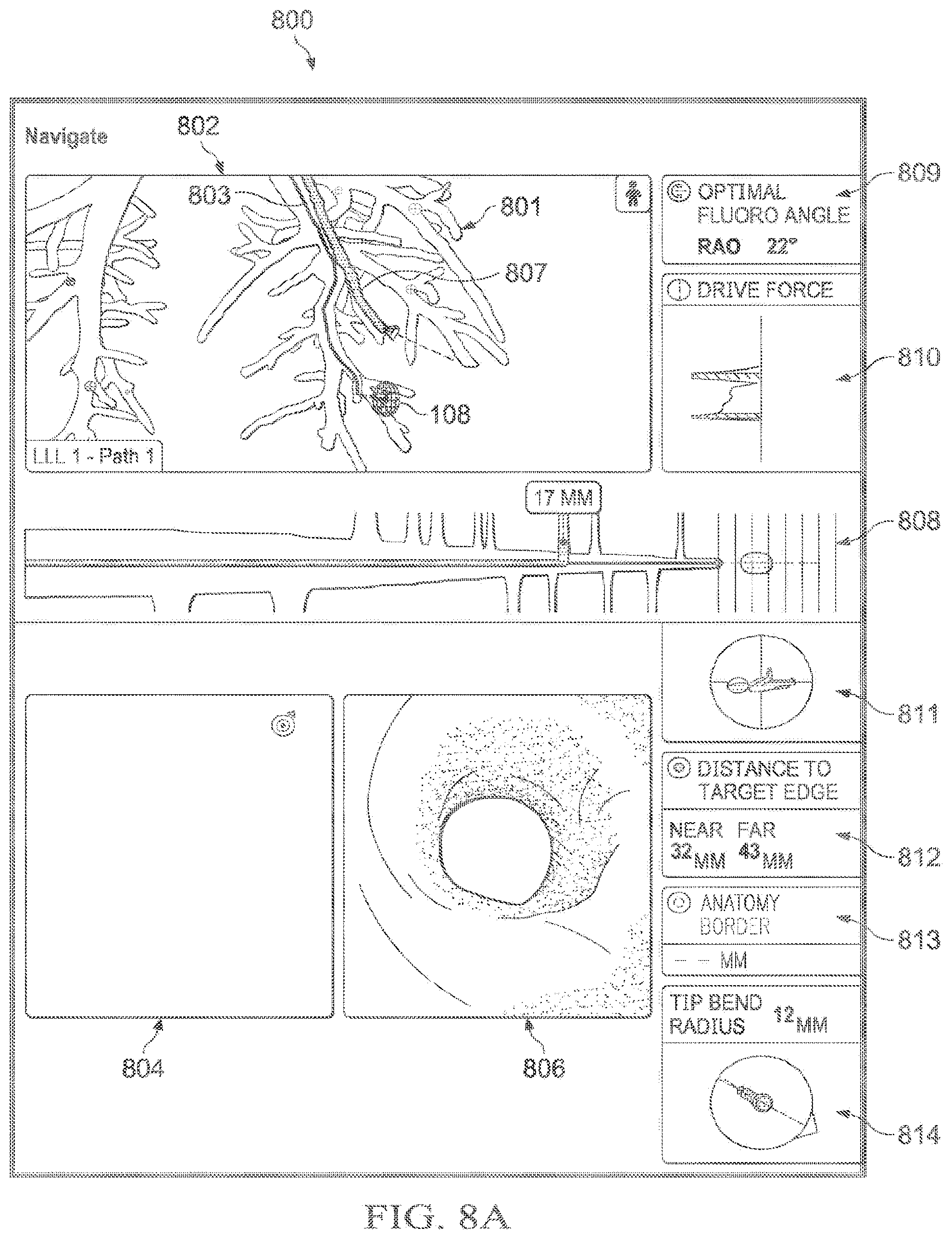 Patent US12597135 Figure 14 – Systems and methods for updating a graphical user interface based upon intraoperative imaging