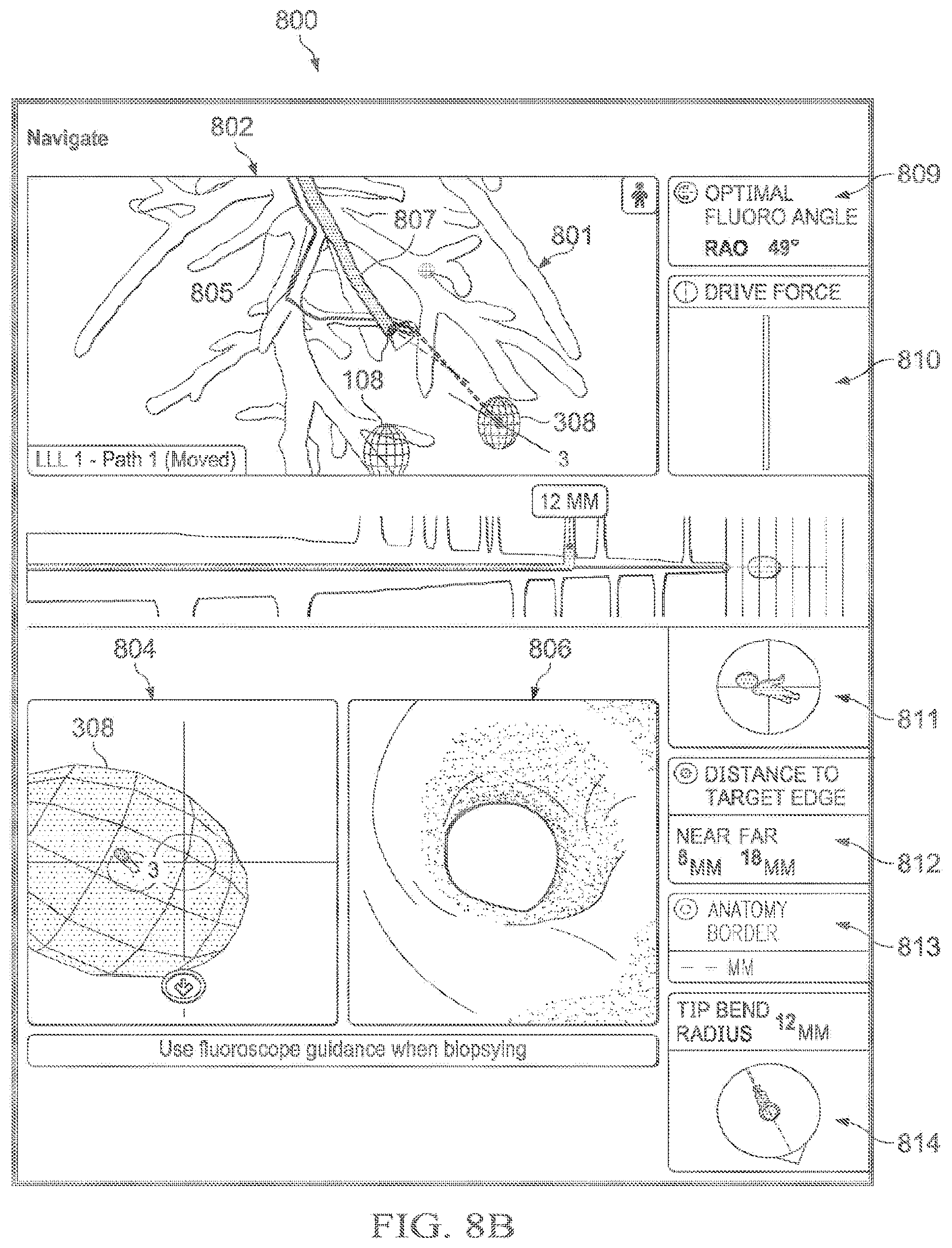 Patent US12597135 Figure 15 – Systems and methods for updating a graphical user interface based upon intraoperative imaging