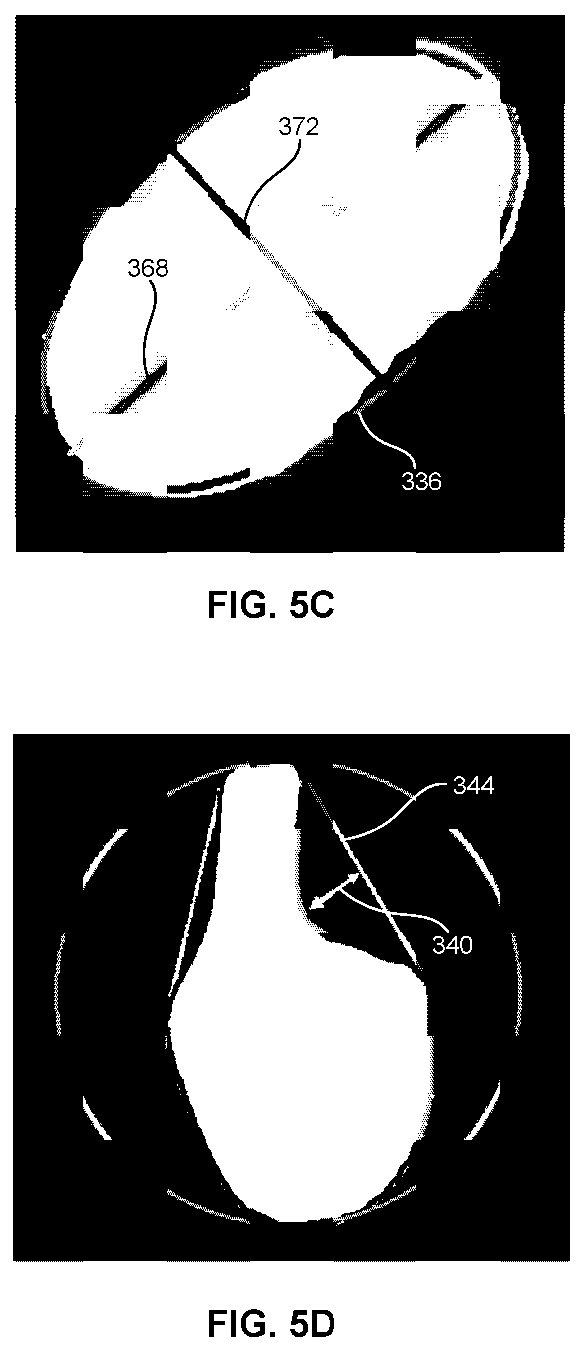 Patent US12597136 Figure 7 – Apparatus and method of recording a storage location by size for harvested tubers