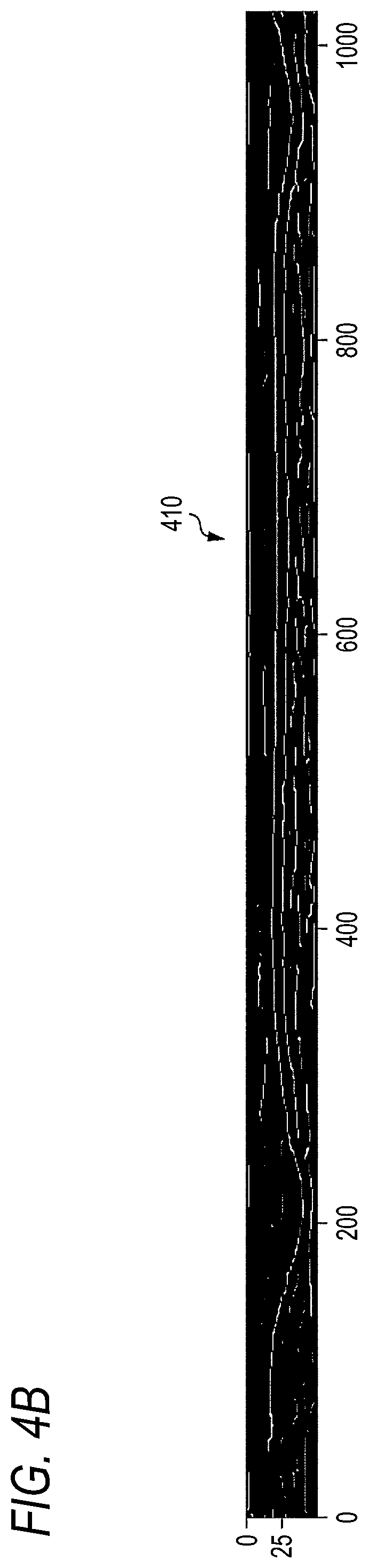 Patent US12597144 Figure 5 – Anterior segment analysis apparatus, anterior segment analysis method, and non-transitory computer-readable storage medium