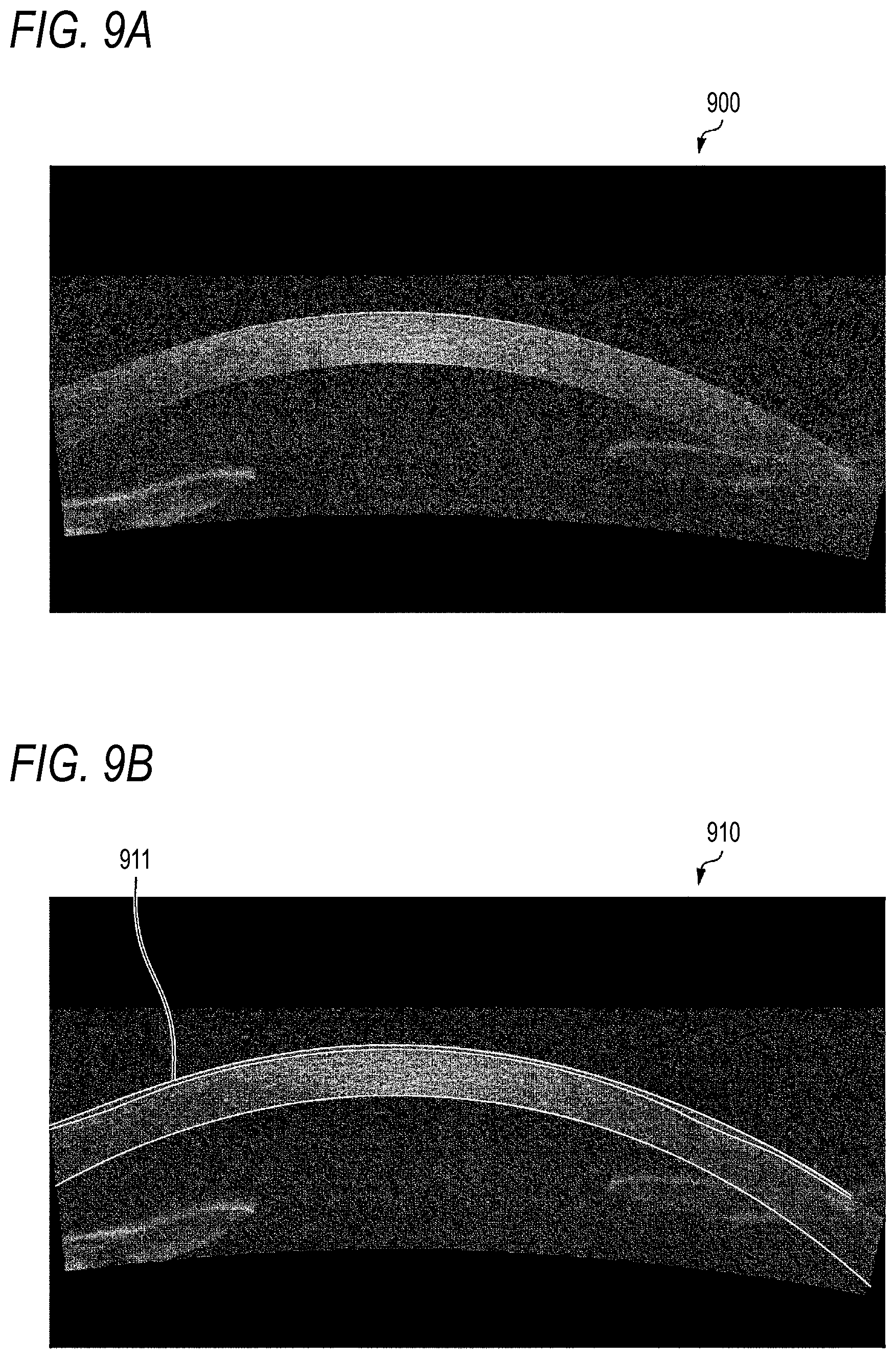 Patent US12597144 Figure 14 – Anterior segment analysis apparatus, anterior segment analysis method, and non-transitory computer-readable storage medium