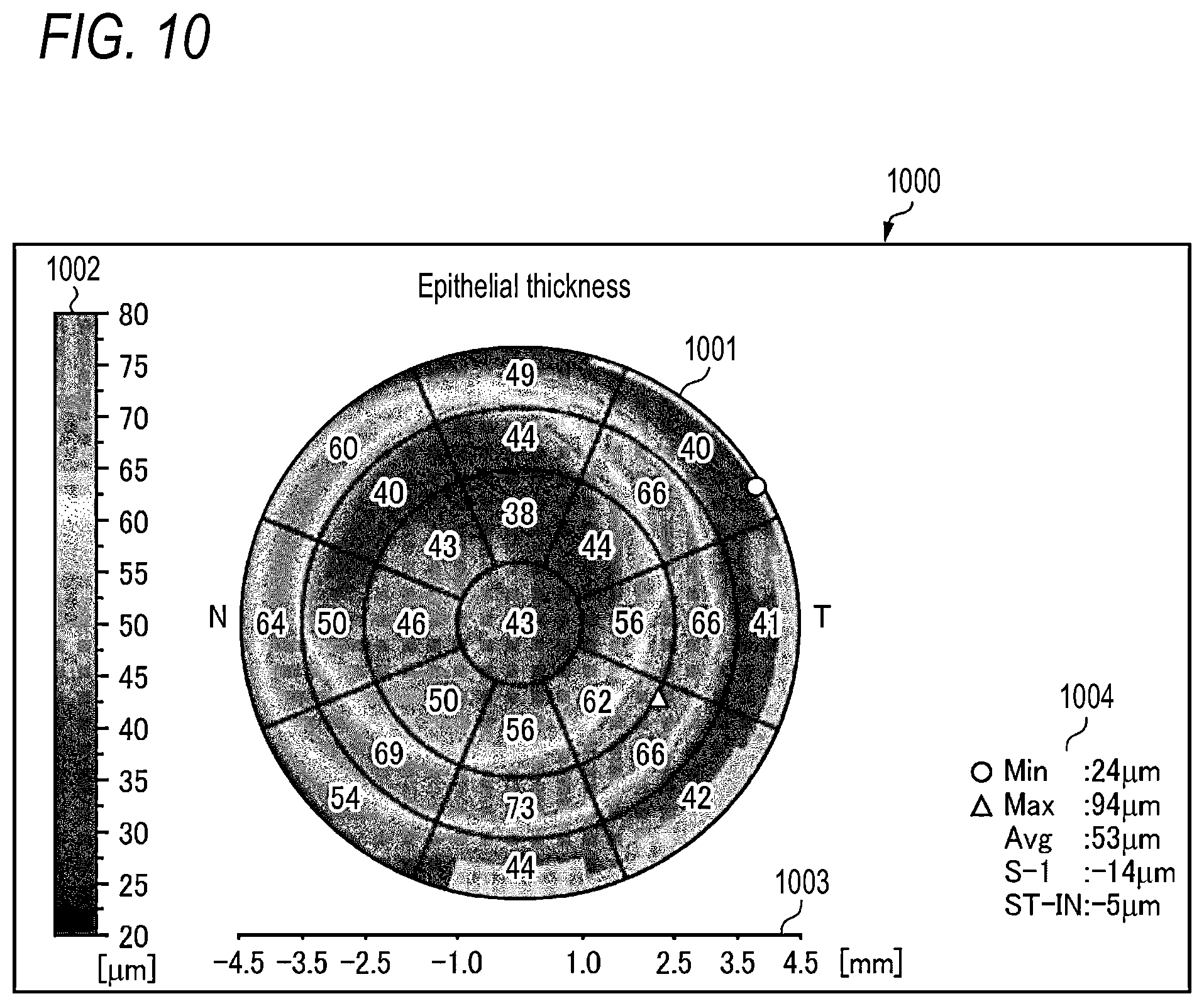 Patent US12597144 Figure 15 – Anterior segment analysis apparatus, anterior segment analysis method, and non-transitory computer-readable storage medium