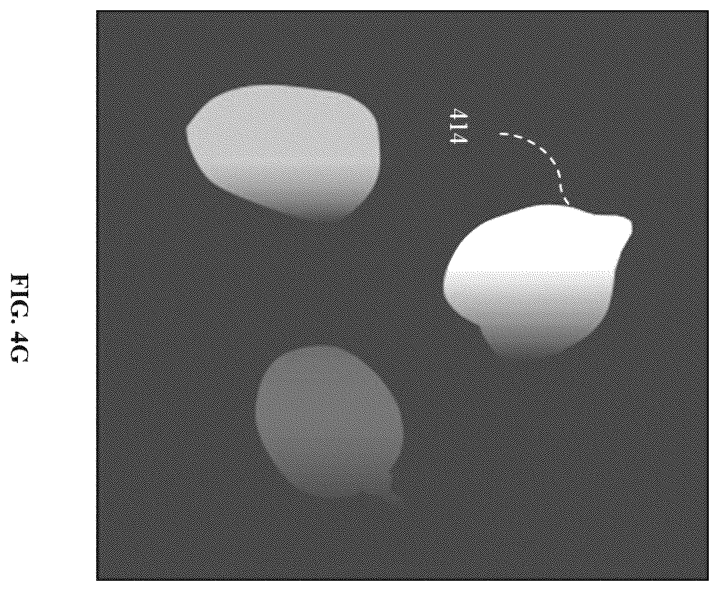 Patent US12597169 Figure 13 – Activity prediction using portable multispectral laser speckle imager