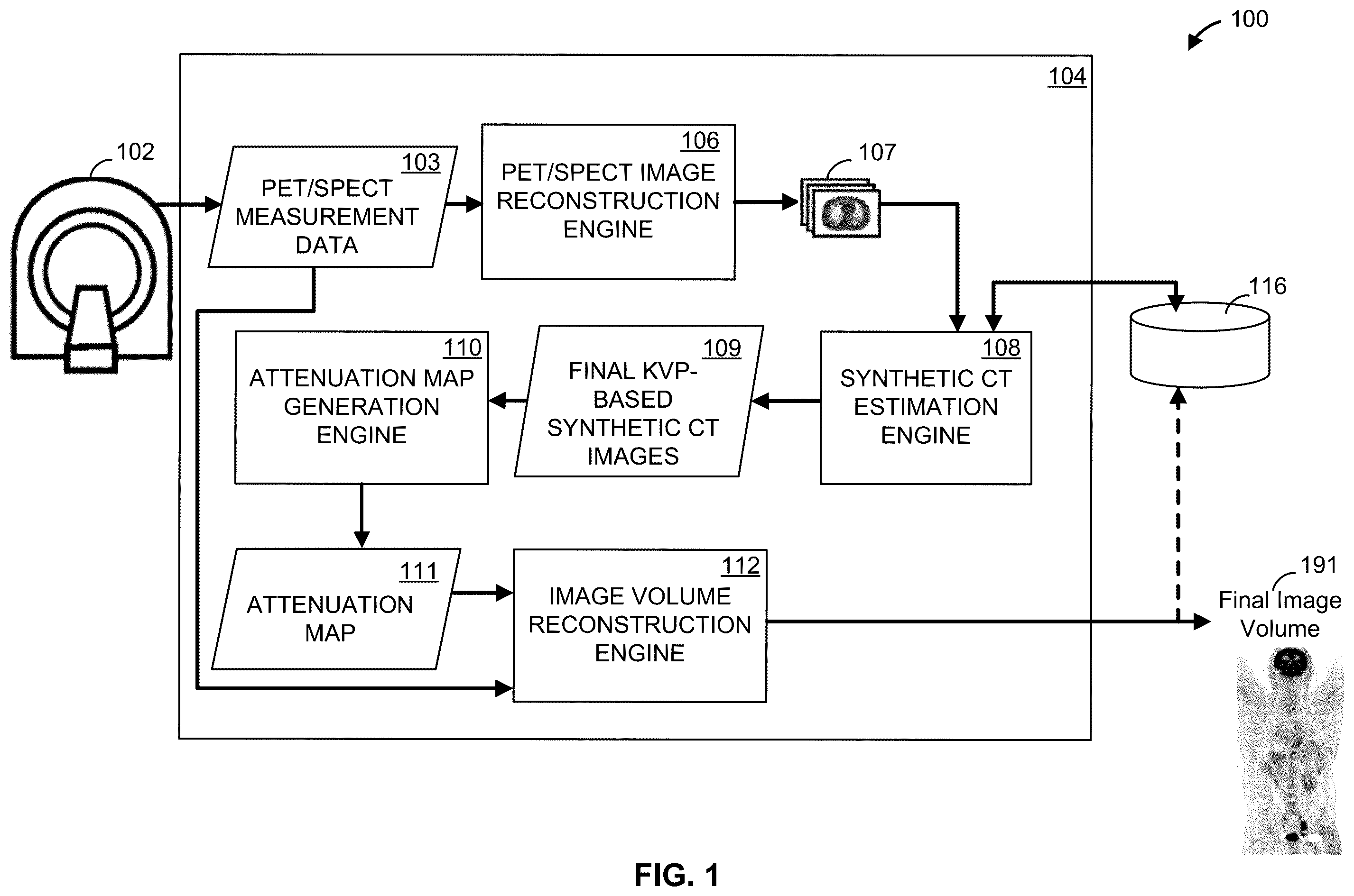 Patent US12597189 Figure 1 – Methods and apparatus for synthetic computed tomography image generation