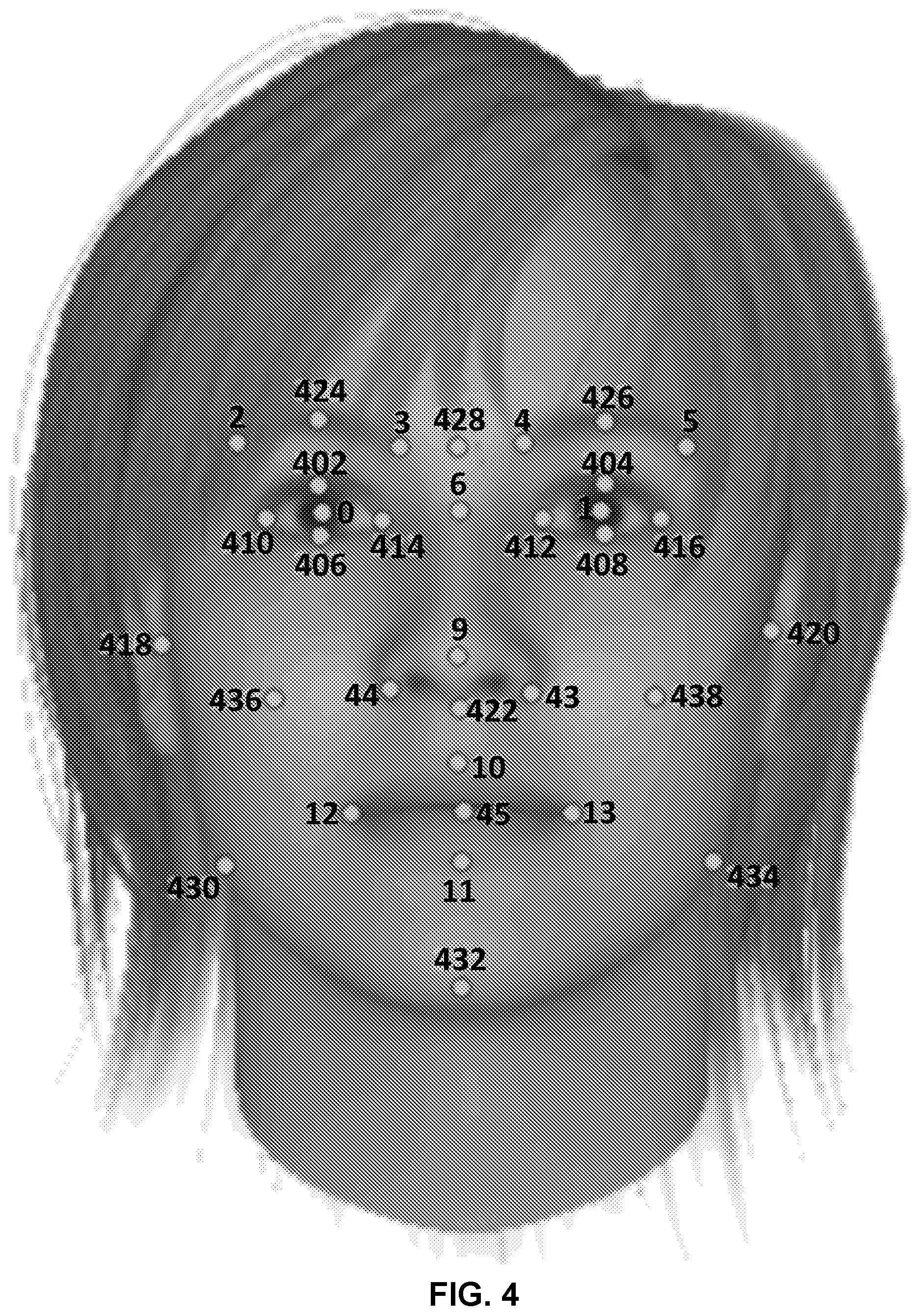 Patent US12597290 Figure 4 – Three-dimensional (3D) facial feature tracking for autostereoscopic telepresence systems