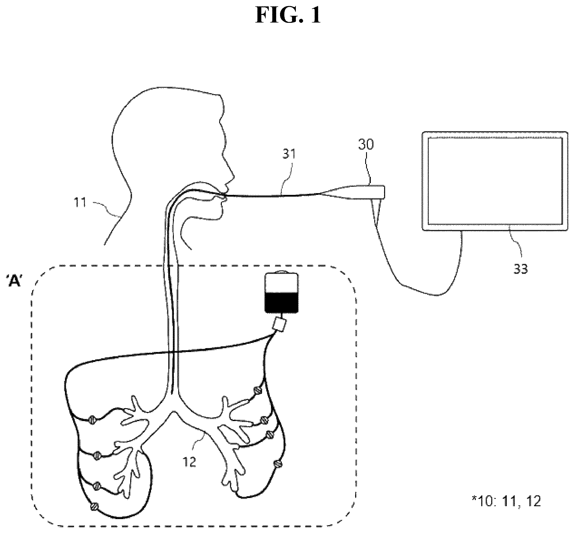 Patent US12597366 — Bronchoscopy simulator and control method for same — Figure 1
