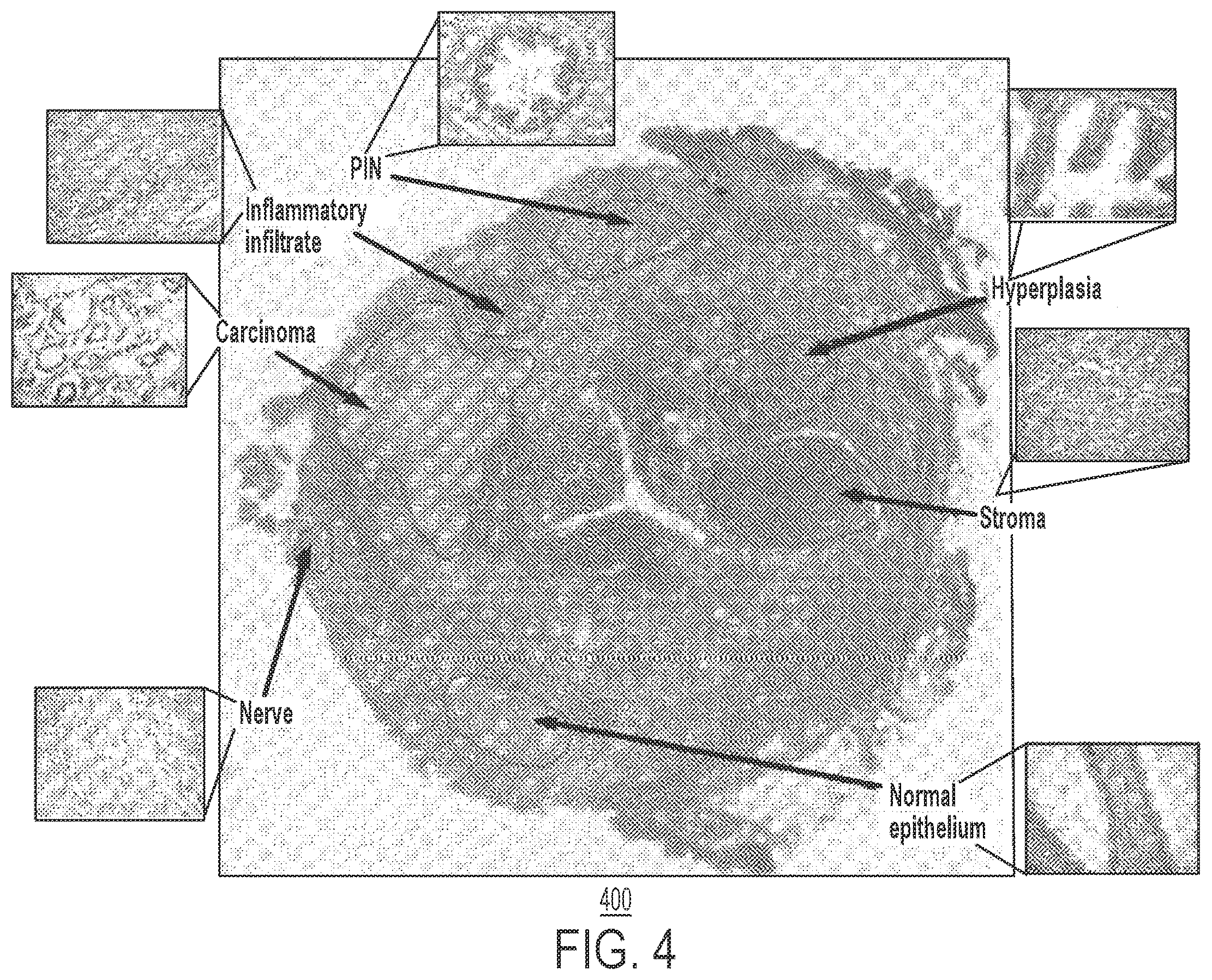 Patent US12597523 Figure 4 – Systems and methods for training a statistical model to predict tissue characteristics for a pathology image