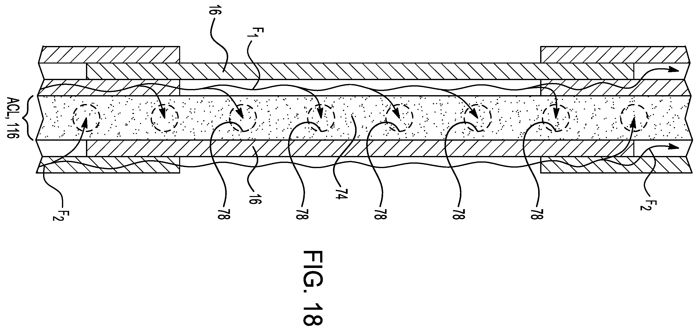 Patent US12597813 Figure 11 – Electric motor with coolant flow at stator slots