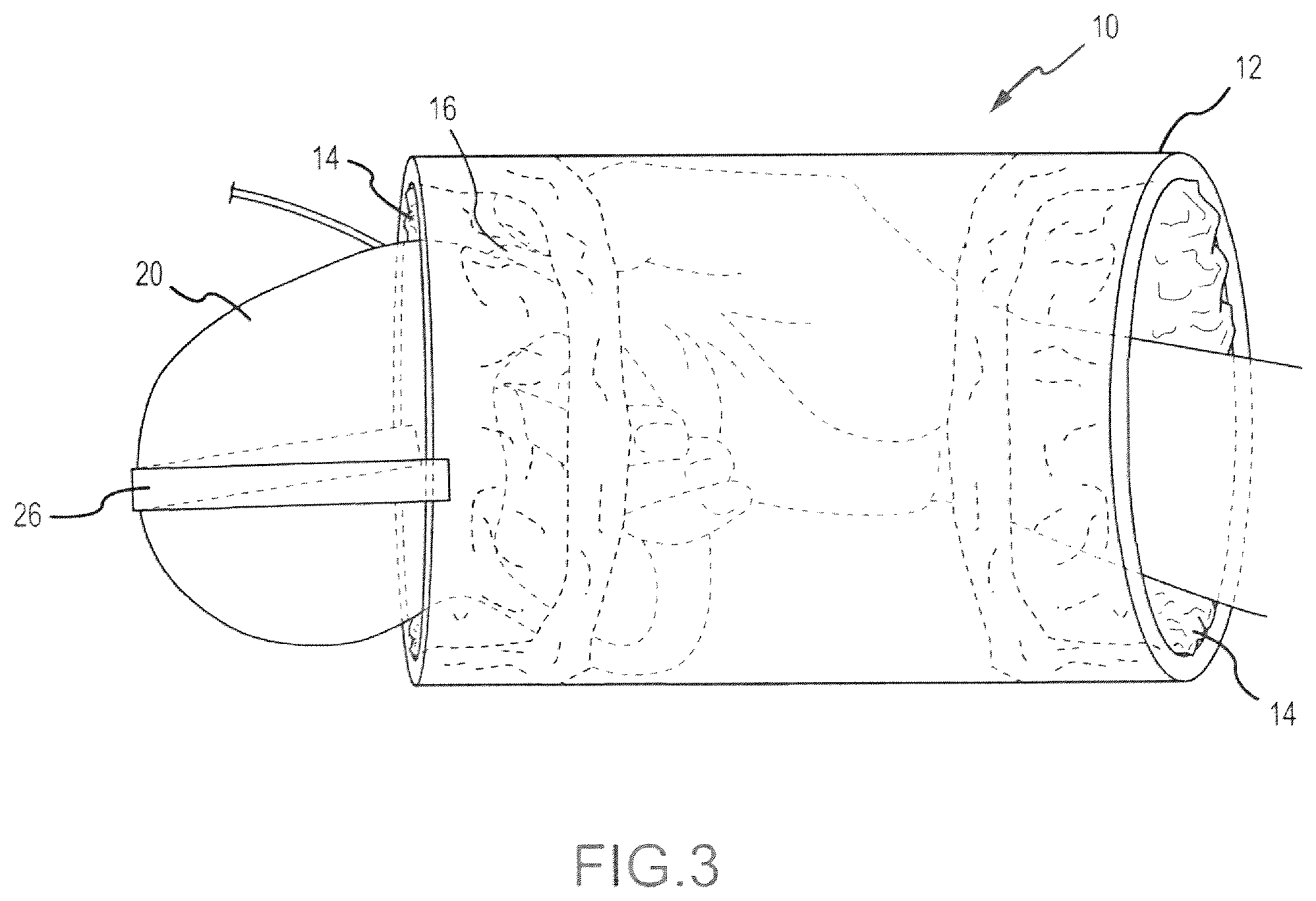 Patent US12599114 Figure 3 – Cover for a retractable dog leash