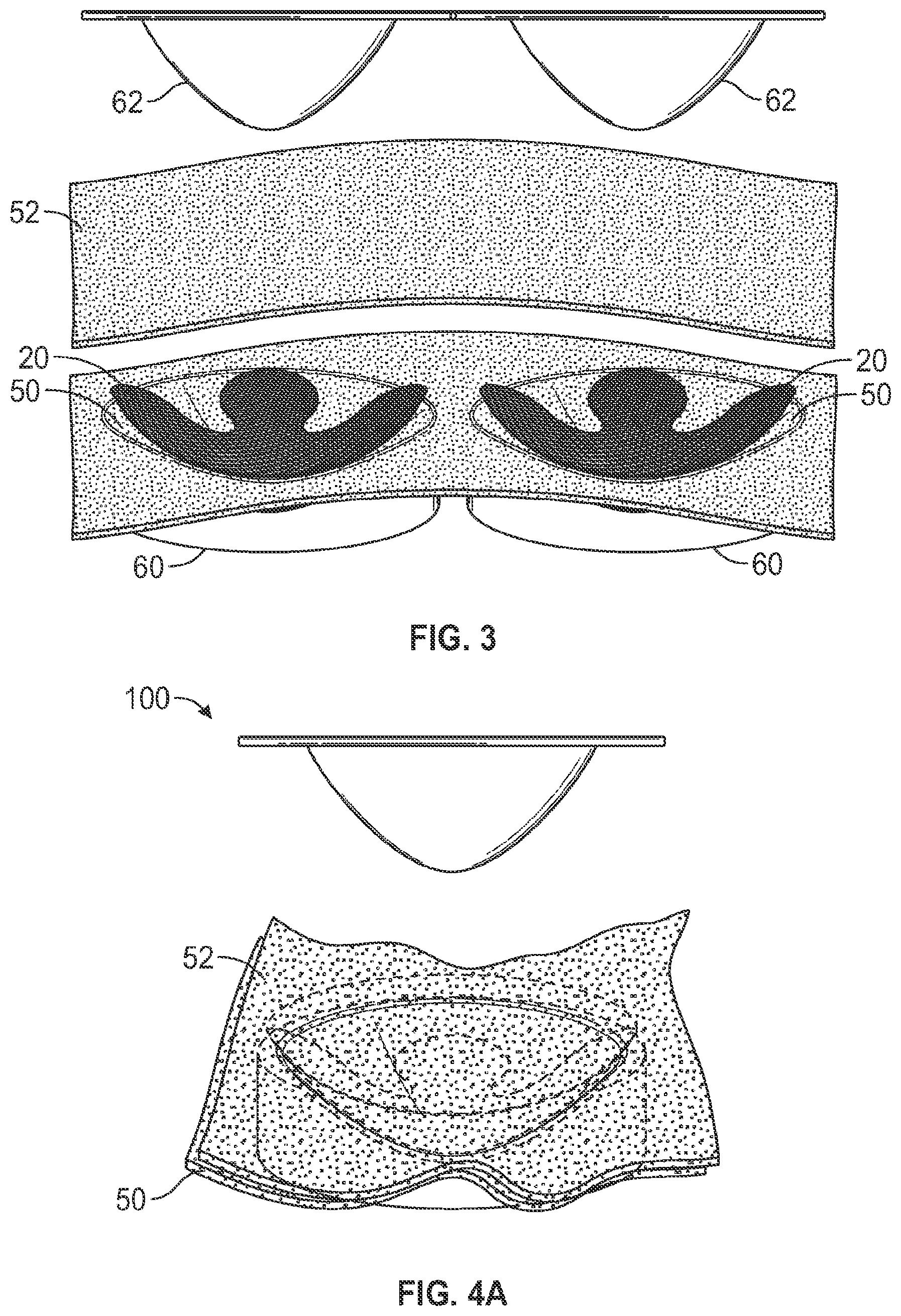 Patent US12599183 Figure 2 – Formed brassiere and associated method of manufacture