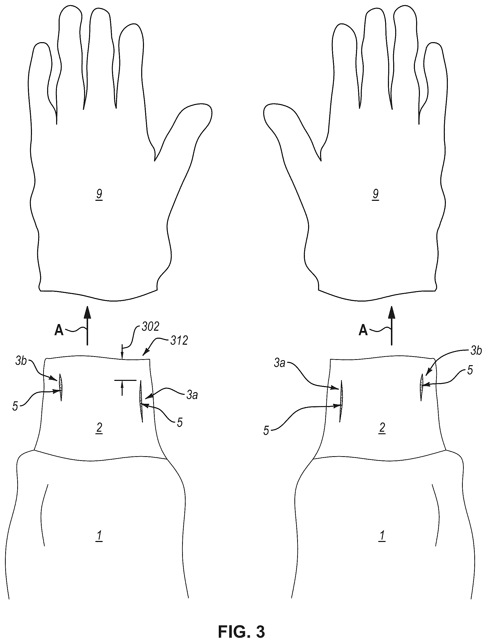 Patent US12599186 Figure 3 – Gown with cuff having integrated perforations