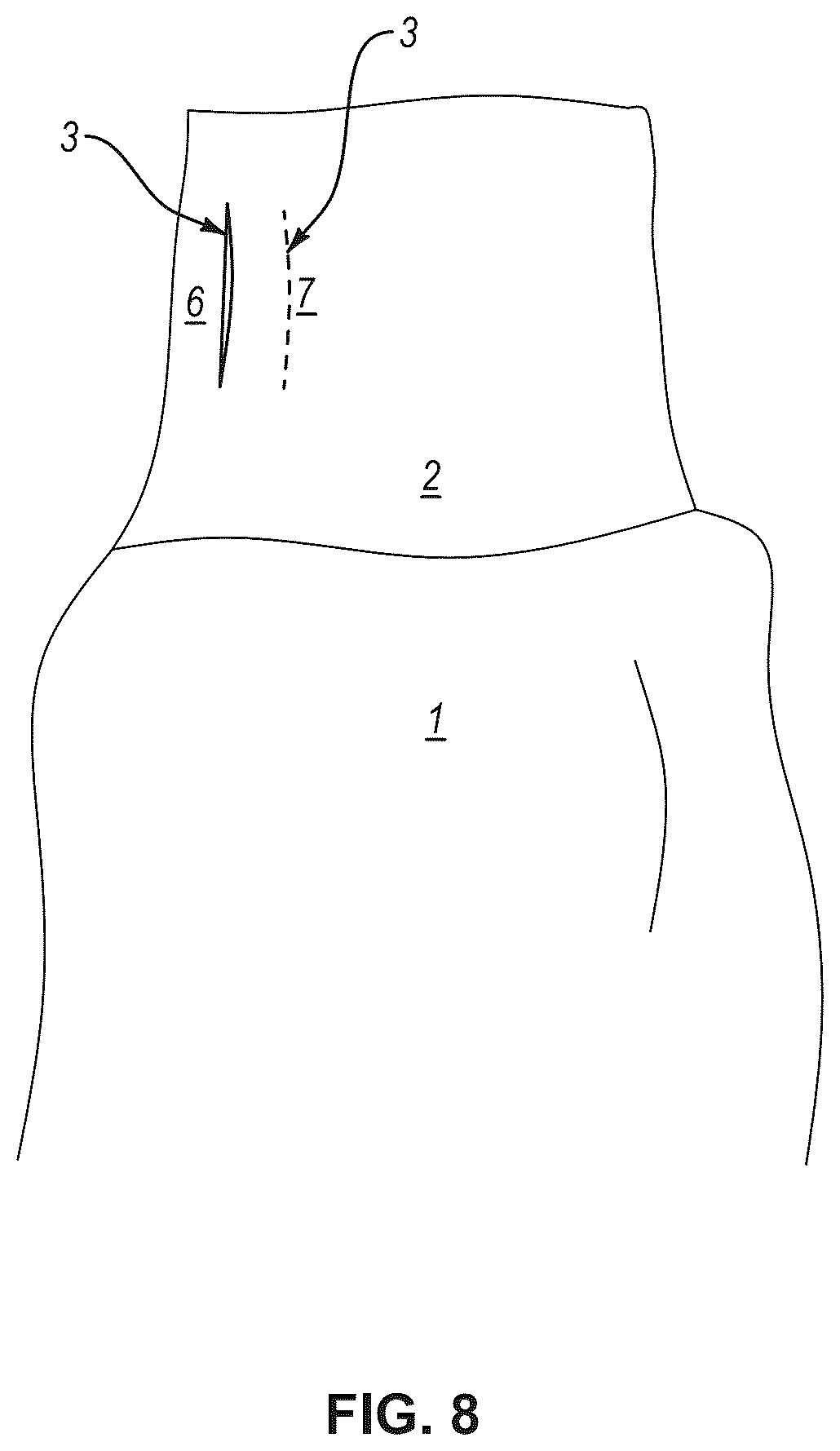 Patent US12599186 Figure 8 – Gown with cuff having integrated perforations