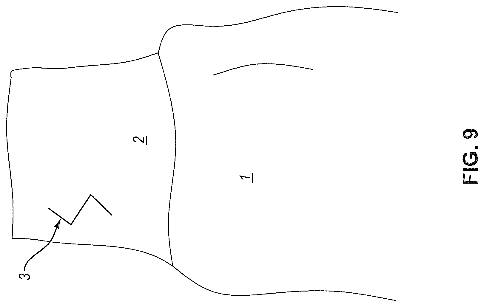 Patent US12599186 Figure 9 – Gown with cuff having integrated perforations