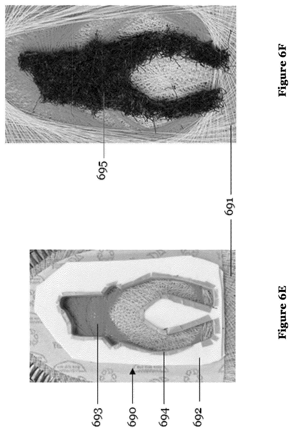 Patent US12599191 Figure 12 – Recycling of waste yarns