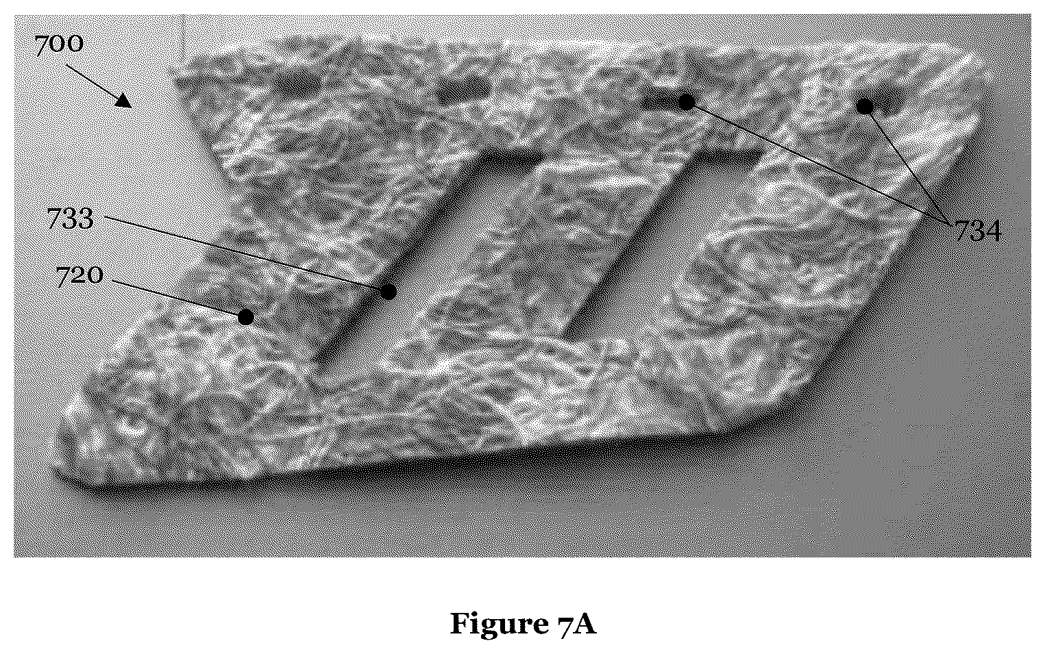 Patent US12599191 Figure 13 – Recycling of waste yarns