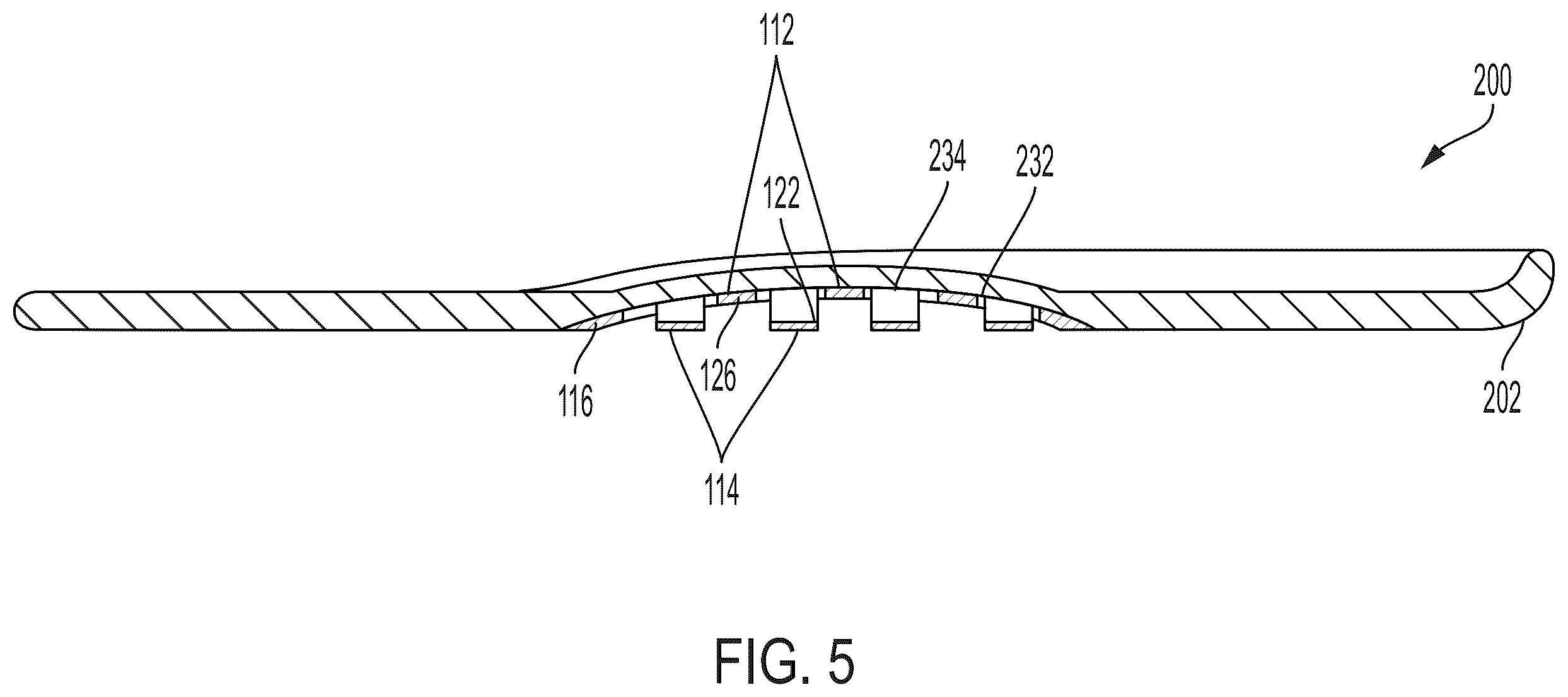 Patent US12599192 Figure 6 – Flexible arch support for footwear