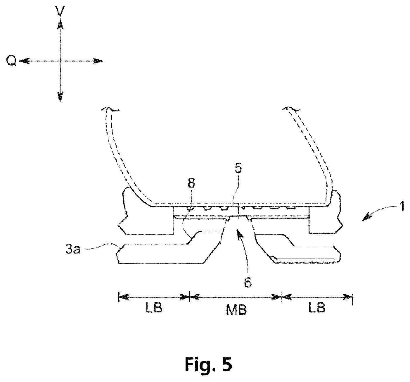 Patent US12599194 Figure 3 – Running shoe sole comprising a soft-elastic midsole
