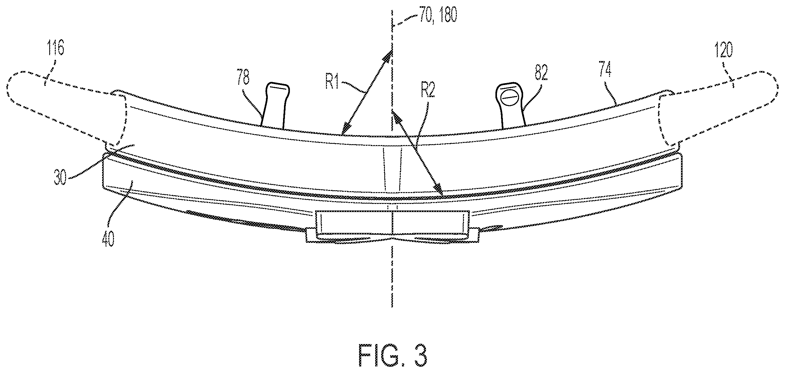 Patent US12599199 Figure 3 – Assembly for coupling an aesthetic member to an accessory
