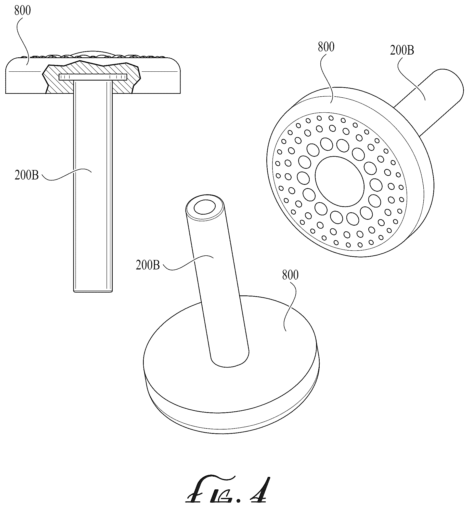 Patent US12599205 Figure 12 – Method of joining titanium and precious metal and products of same
