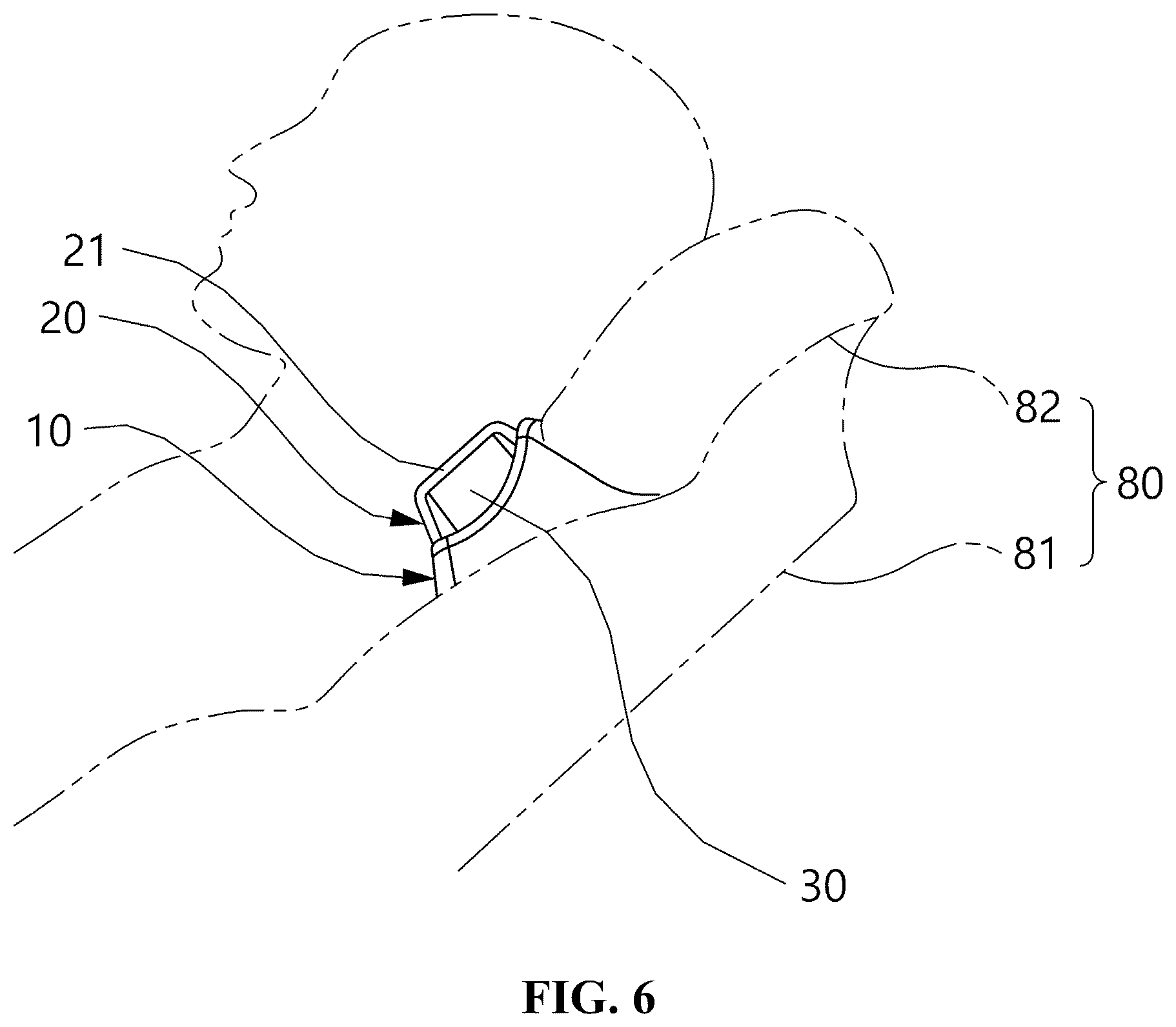 Patent US12599238 Figure 6 – Neck supporting device