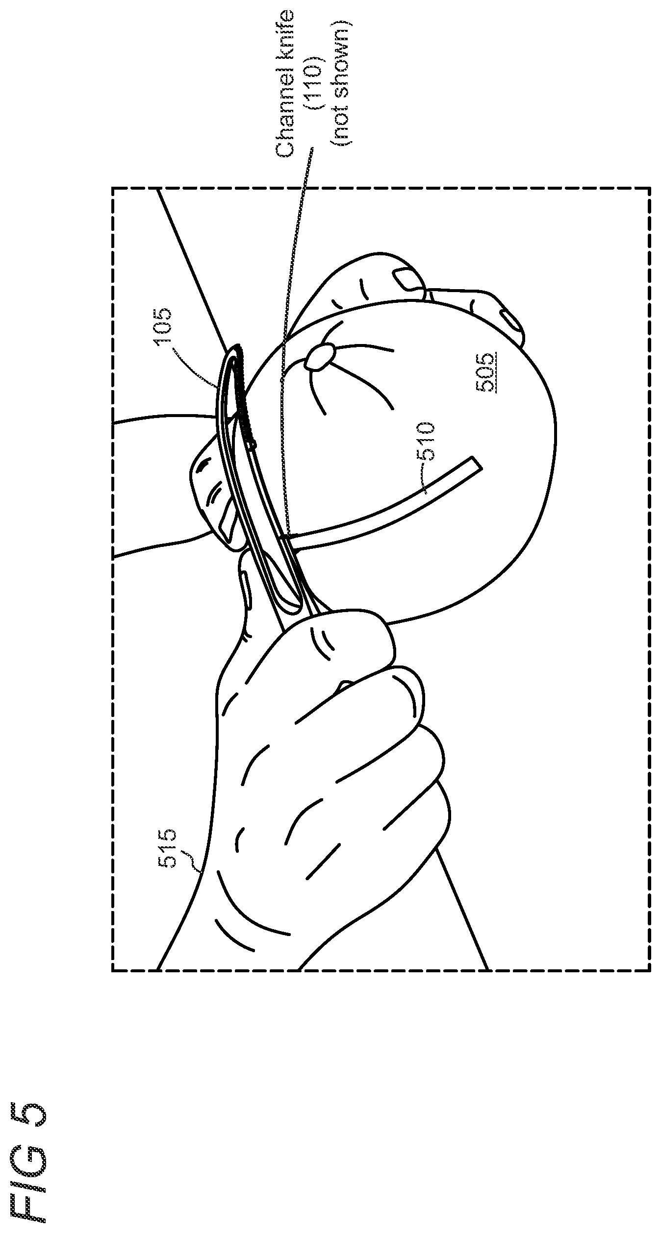 Patent US12599264 Figure 3 – Citrus peeler