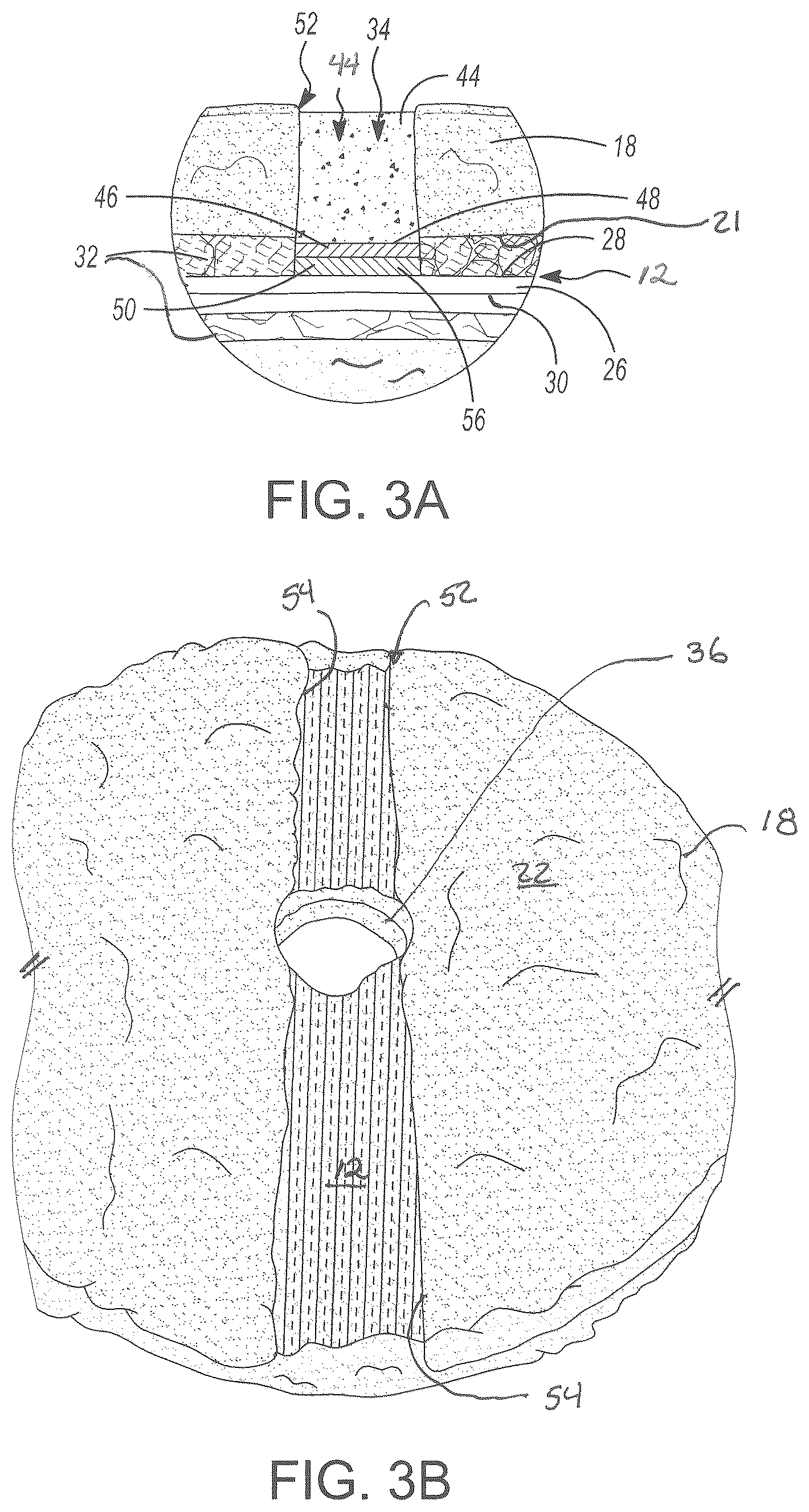 Patent US12599278 Figure 2 – Rotary floor buffing pad with agitator insert
