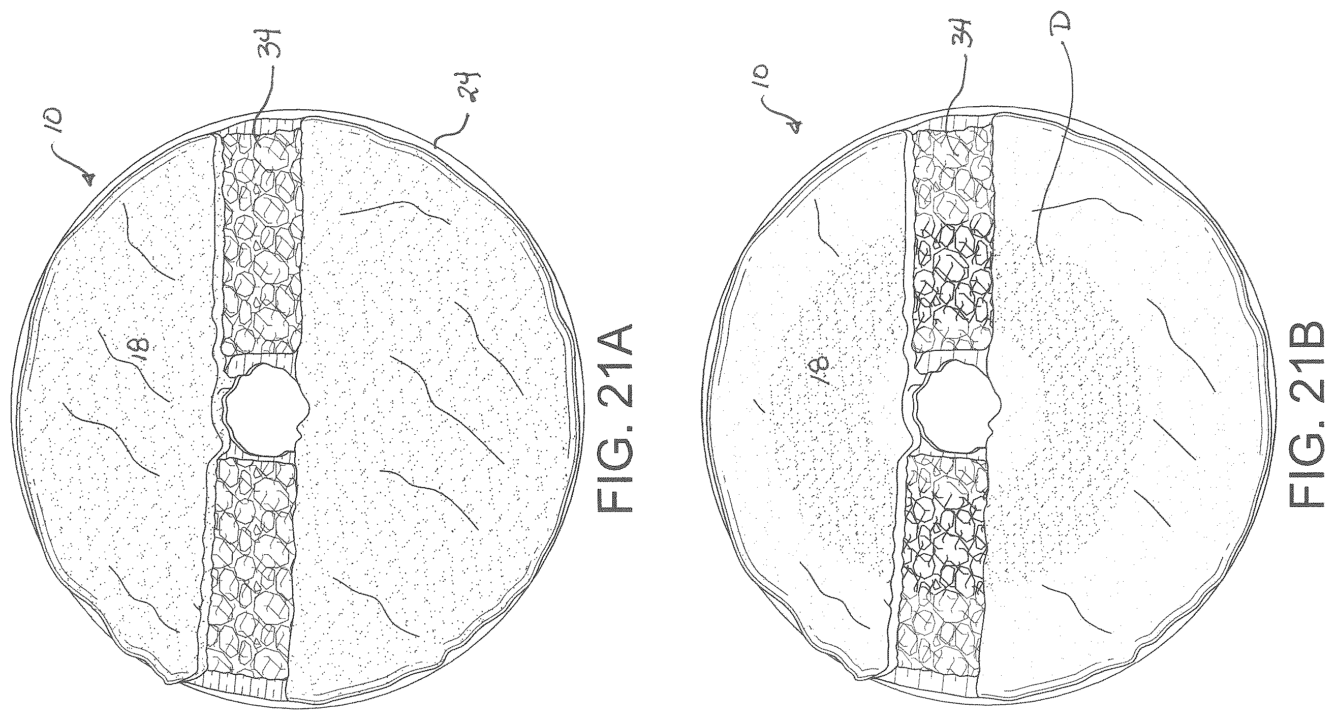 Patent US12599278 Figure 15 – Rotary floor buffing pad with agitator insert