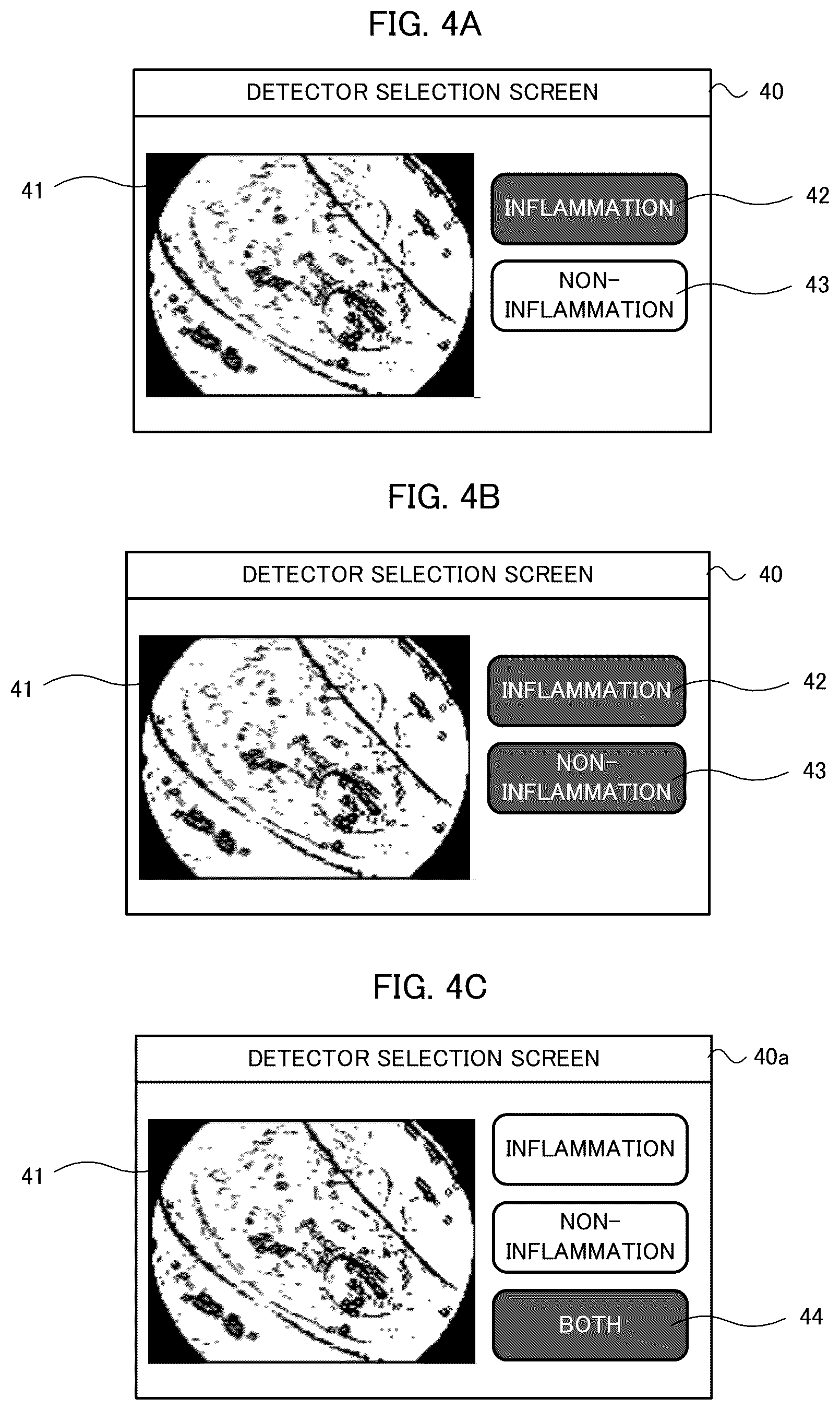 Patent US12599284 Figure 4 – Endoscopic examination support apparatus, endoscopic examination support method, and recording medium