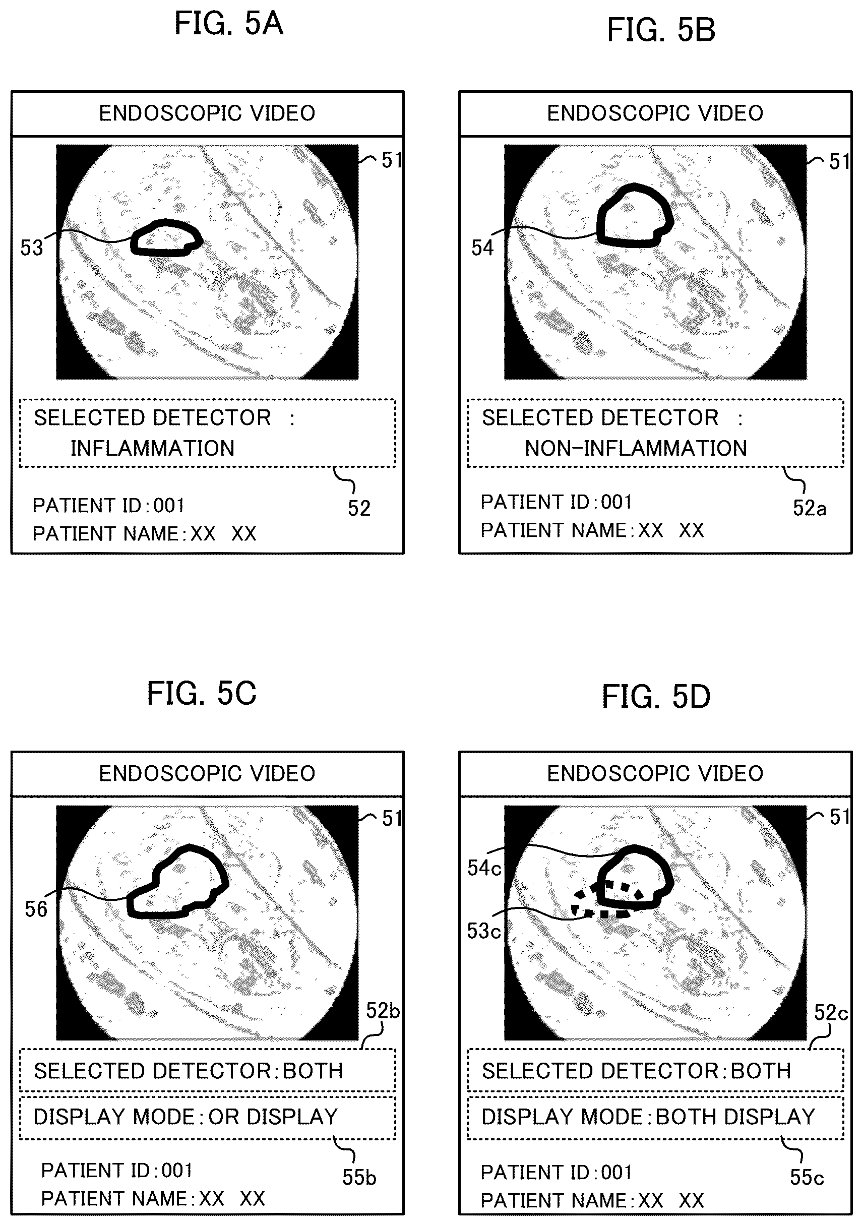 Patent US12599284 Figure 5 – Endoscopic examination support apparatus, endoscopic examination support method, and recording medium