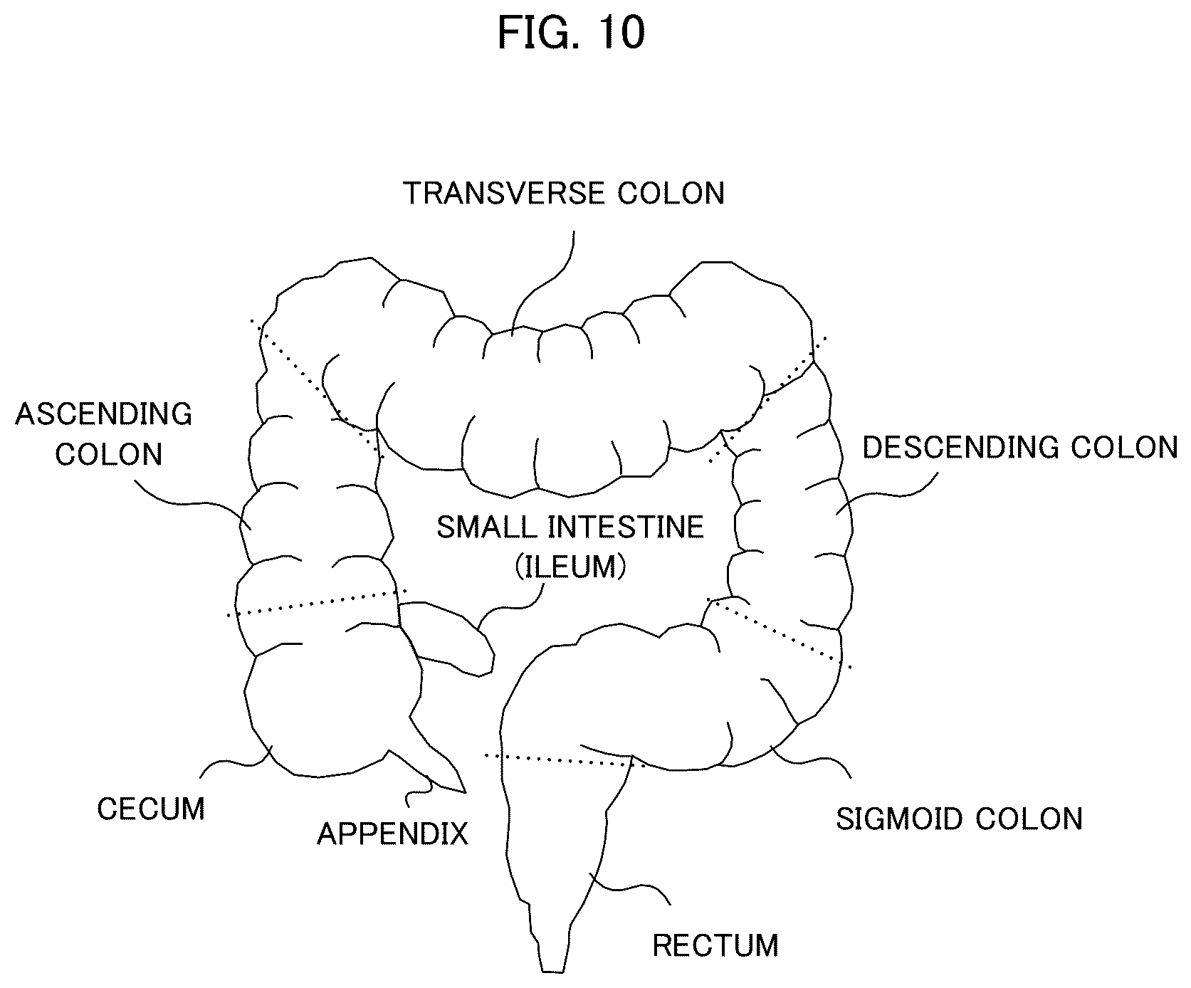 Patent US12599284 Figure 10 – Endoscopic examination support apparatus, endoscopic examination support method, and recording medium