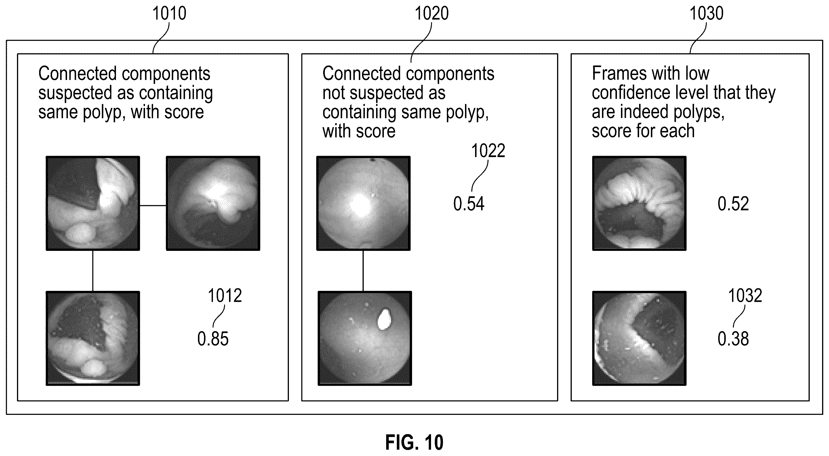 Patent US12599285 Figure 9 – Analysis of in-vivo images using connected graph components