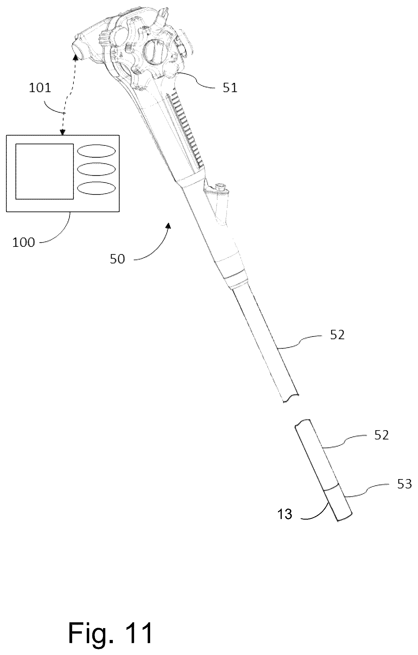 Patent US12599292 Figure 6 – Articulated bending section body for an insertion endoscope