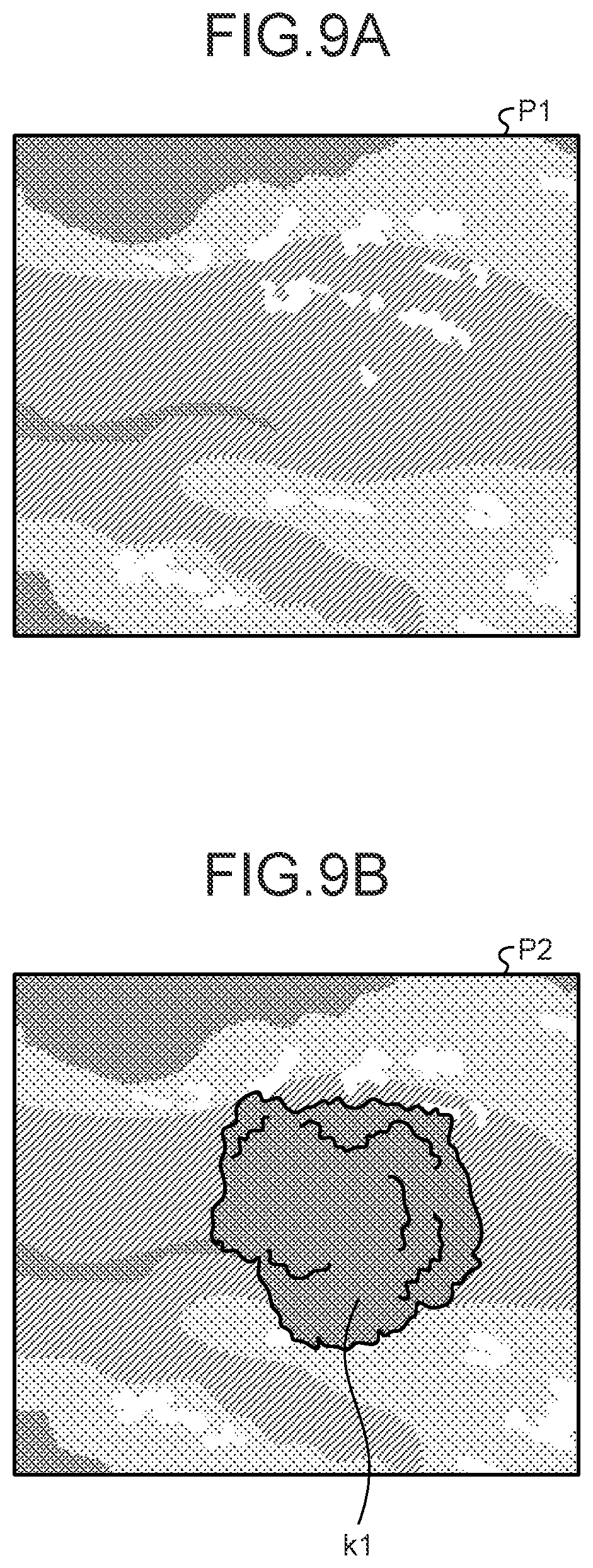 Patent US12599293 Figure 8 – Assist device, endoscope system, assist method and computer-readable recording medium