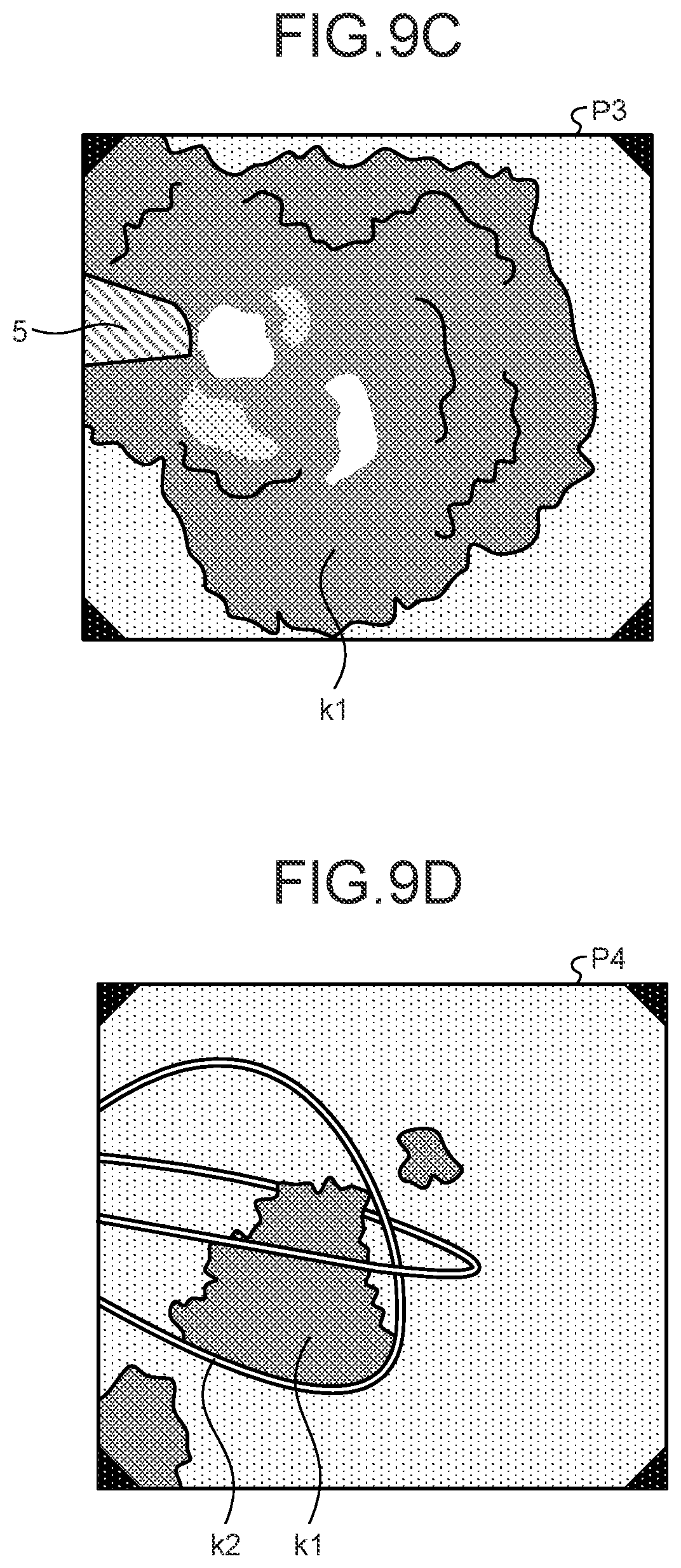 Patent US12599293 Figure 9 – Assist device, endoscope system, assist method and computer-readable recording medium