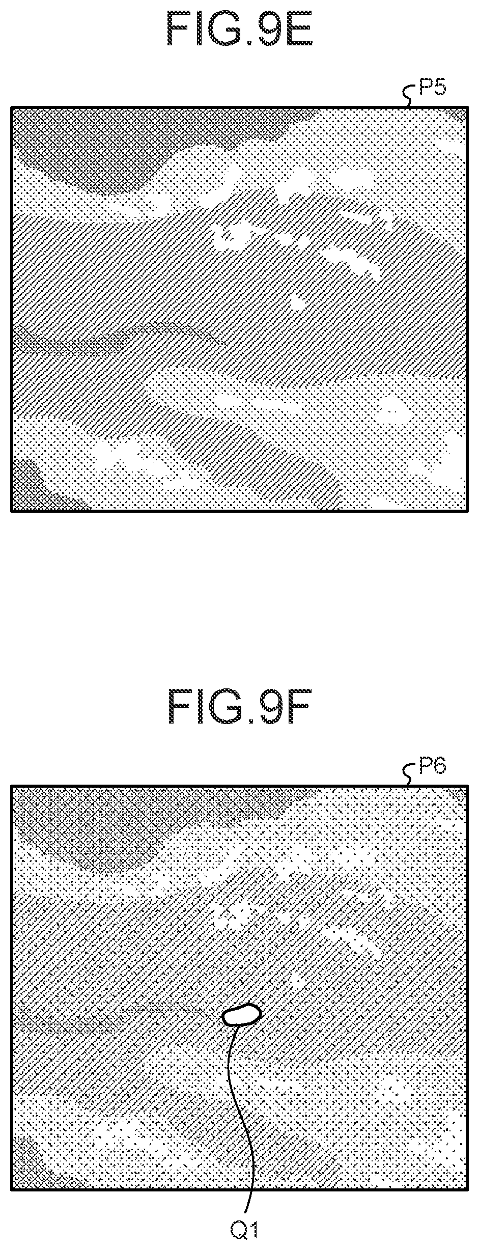 Patent US12599293 Figure 10 – Assist device, endoscope system, assist method and computer-readable recording medium