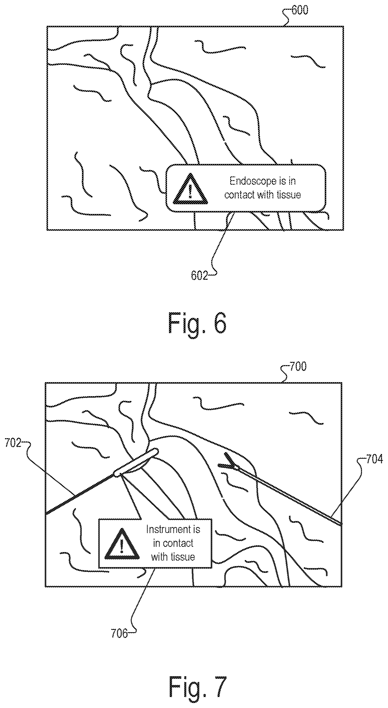 Patent US12599298 Figure 4 – Systems and methods for detecting physical contact of a surgical instrument with patient tissue