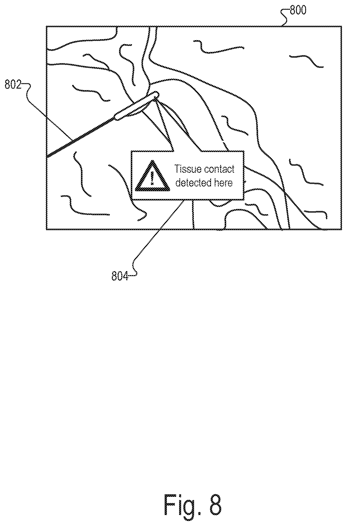 Patent US12599298 Figure 5 – Systems and methods for detecting physical contact of a surgical instrument with patient tissue