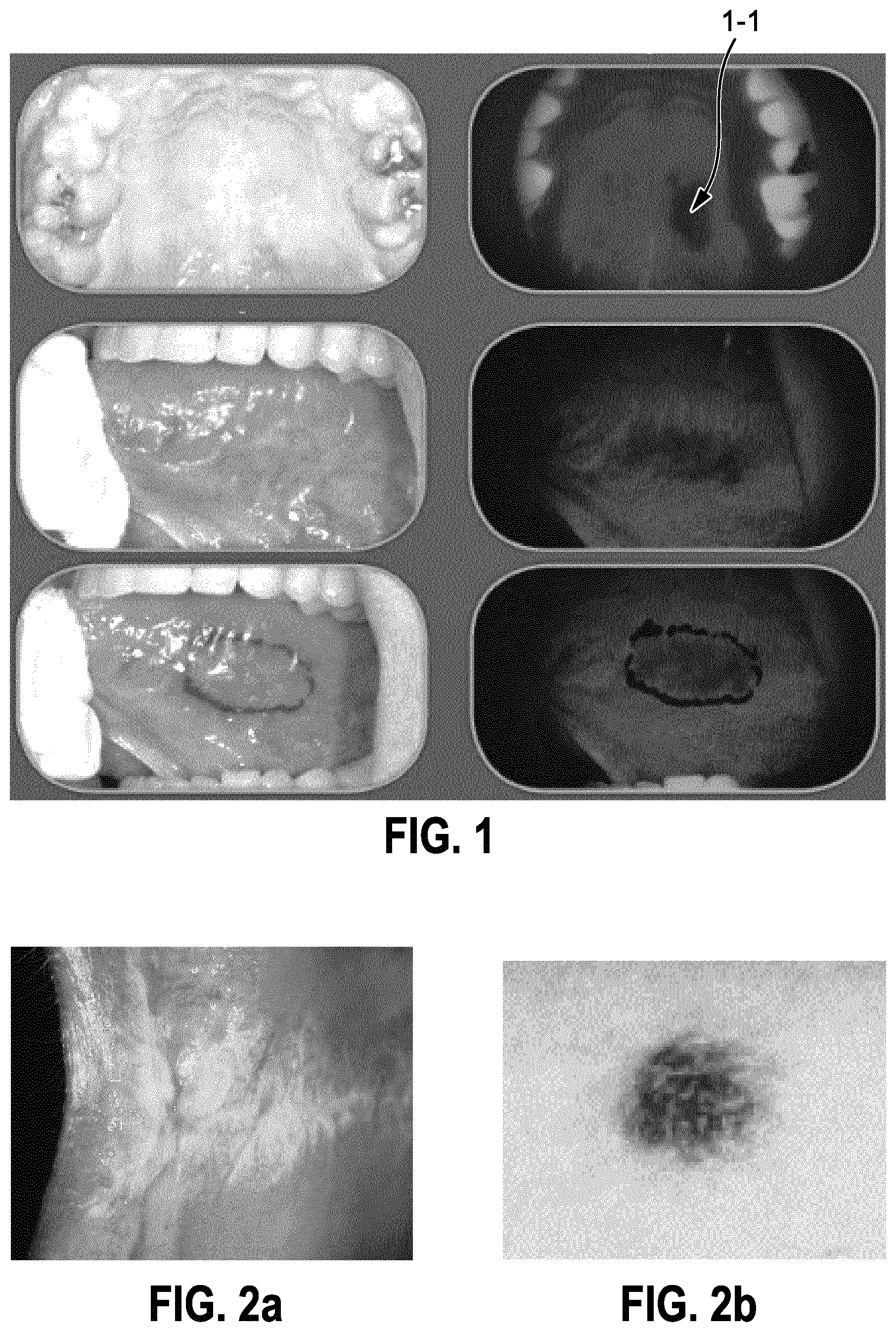Patent US12599299 Figure 1 – Method and apparatus for multimodal soft tissue diagnostics