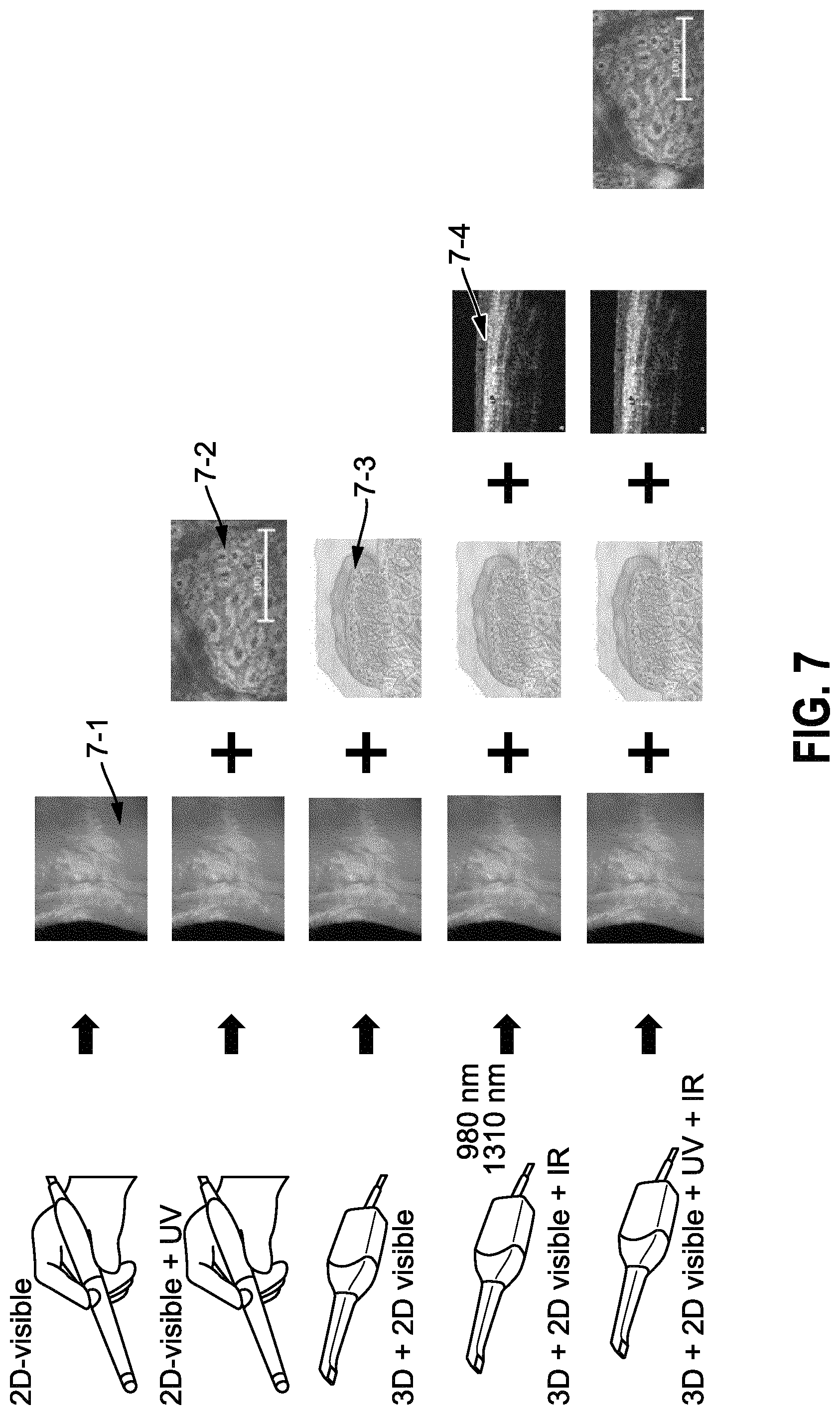 Patent US12599299 Figure 4 – Method and apparatus for multimodal soft tissue diagnostics
