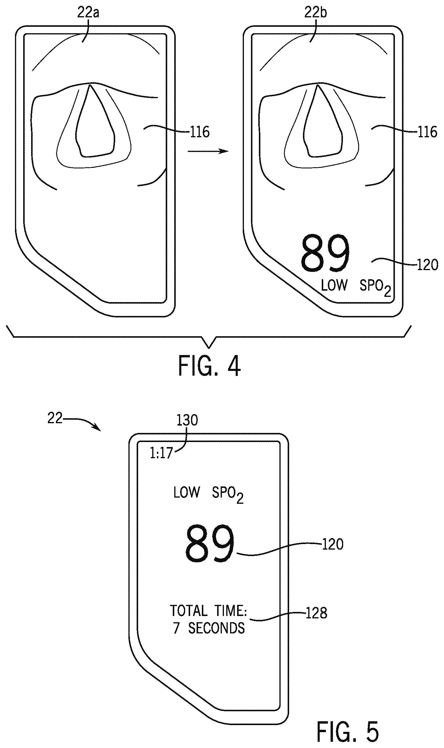 Patent US12599300 Figure 4 – Laryngoscope with physiological parameter indicator