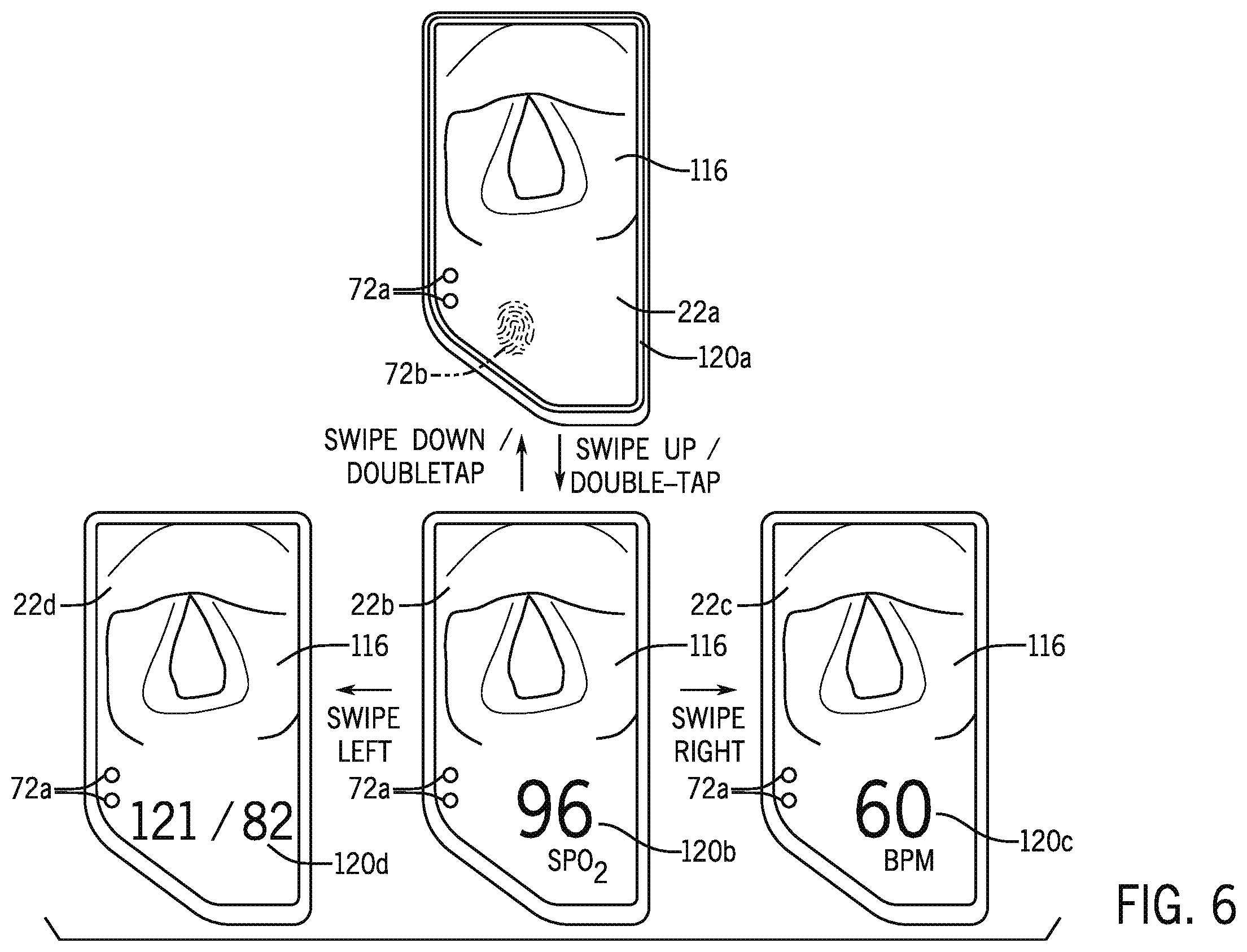 Patent US12599300 Figure 5 – Laryngoscope with physiological parameter indicator