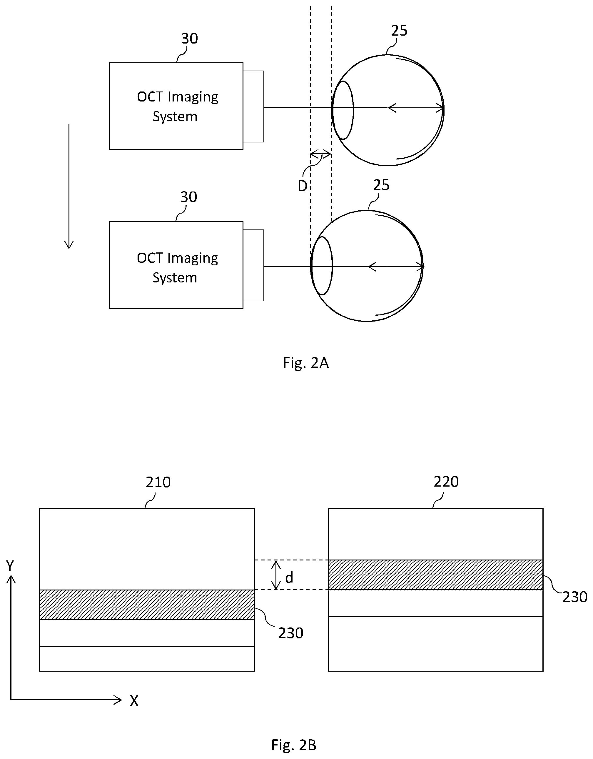 Patent US12599302 Figure 2 – Volumetric OCT image data processing